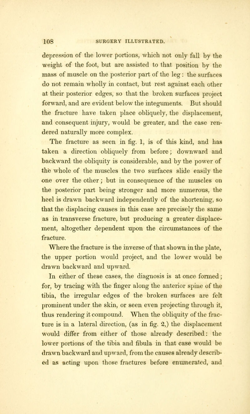 depression of the lower portions, which not only fall by the weight of the foot, but are assisted to that position by the mass of muscle on the posterior part of the leg : the surfaces do not remain wholly in contact, but rest against each other at their posterior edges, so that the broken surfaces project forward, and are evident below the integuments. But should the fracture have taken place obliquely, the displacement, and consequent injury, would be greater, and the case ren- dered naturally more complex. The fracture as seen in fig. 1, is of this kind, and has taken a direction obliquely from before; downward and backward the obliquity is considerable, and by the power of the whole of the muscles the two surfaces slide easily the one over the other; but in consequence of the muscles on the posterior part being stronger and more numerous, the heel is drawn backward independently of the shortening, so that the displacing causes in this case are precisely the same as in transverse fracture, but producing a greater displace- ment, altogether dependent upon the circumstances of the fracture. Where the fracture is the inverse of that shown in the plate, the upper portion would project, and the lower would be drawn backward and upward. In either of these cases, the diagnosis is at once formed; for, by tracing with the finger along the anterior spine of the tibia, the irregular edges of the broken surfaces are felt prominent under the skin, or seen even projecting through it, thus rendering it compound. When the obliquity of the frac- ture is in a lateral direction, (as in fig. 2,) the displacement would differ from either of those already described: the lower portions of the tibia and fibula in that case would be drawn backward and upward, from the causes already describ- ed as acting upon those fractures before enumerated, and