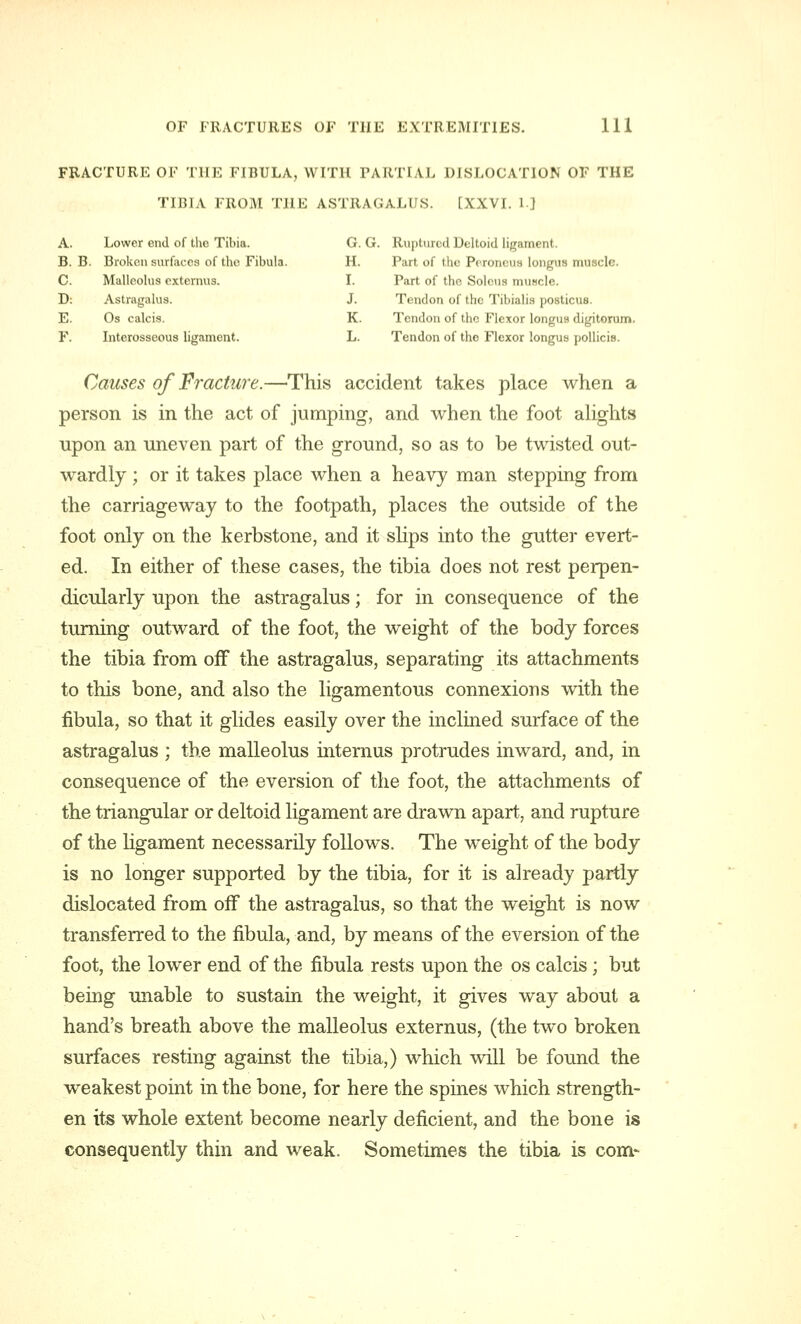 FRACTURE OF THE FIBULA, WITH PARTIAL DISLOCATION OF THE TIBIA FROM THE ASTRAGALUS. [XXVI. 1] A. Lower end of the Tibia. G.G. Ruptured Deltoid ligament. B. B. Broken surfaces of the Fibula. H. Part of the Poroneus longus muscle. C. Malleolus externus. I. Part of the Solcus muscle. D: Astragalus. J. Tendon of the Tibialis posticus. E. Os calcis. K. Tendon of the Flexor longus digitorum. F. Interosseous ligament. L. Tendon of the Flexor longus pollicis. Causes of Fracture.—This accident takes place when a person is in the act of jumping, and when the foot alights upon an uneven part of the ground, so as to be twisted out- wardly ; or it takes place when a heavy man stepping from the carriageway to the footpath, places the outside of the foot only on the kerbstone, and it slips into the gutter evert- ed. In either of these cases, the tibia does not rest perpen- dicularly upon the astragalus; for in consequence of the turning outward of the foot, the weight of the body forces the tibia from oiF the astragalus, separating its attachments to this bone, and also the ligamentous connexions with the fibula, so that it glides easily over the inclined surface of the astragalus ; the malleolus internus protrudes inward, and, in consequence of the eversion of the foot, the attachments of the triangular or deltoid ligament are drawn apart, and rupture of the ligament necessarily follows. The weight of the body is no longer supported by the tibia, for it is already partly dislocated from off the astragalus, so that the weight is now transferred to the fibula, and, by means of the eversion of the foot, the lower end of the fibula rests upon the os calcis; but being unable to sustain the weight, it gives way about a hand's breath above the malleolus externus, (the two broken surfaces resting against the tibia,) which will be found the weakest point in the bone, for here the spines which strength- en its whole extent become nearly deficient, and the bone is consequently thin and weak. Sometimes the tibia is com-