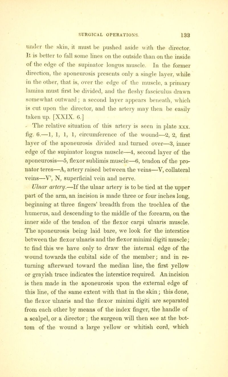 under the skin, it must be pushed aside with the director. It is better to fall some lines on the outside than on the inside of the edge of the supinator longus muscle. In the former direction, the aponeurosis presents only a single layer, while in the other, that is, over the edge of the muscle, a primary lamina must first be divided, and the fleshy fasciculus drawn somewhat outward; a second layer appears beneath, which is cut upon the director, and the artery may then be easily taken up. [XXIX. 6.] The relative situation of this artery is seen in plate xxx. fig. 6.—1, 1, 1, 1, circumference of the wound—2, 2, first layer of the aponeurosis divided and turned over—3, inner edge of the supinator longus muscle—4, second layer of the aponeurosis—5, flexor sublimis muscle—6, tendon of the pro- nator teres—A, artery raised between the veins—V, collateral veins—V, N, superficial vein and nerve. Ulnar artery.—If the ulnar artery is to be tied at the upper part of the arm, an incision is made three or four inches long, beginning at three fingers' breadth from the trochlea of the humerus, and descending to the middle of the forearm, on the inner side of the tendon of the flexor carpi ulnaris muscle. The aponeurosis being laid bare, we look for the interstice between the flexor ulnaris and the flexor minimi digiti muscle; tc find this we have only to draw the internal edge of the wound towards the cubital side of the member; and in re- turning afterward toward the median line, the first yellow or grayish trace indicates the interstice required. An incision is then made in the aponeurosis upon the external edge of this line, of the same extent with that in the skin; this done, the flexor ulnaris and the flexor minimi digiti are separated from each other by means of the index finger, the handle of a scalpel, or a director; the surgeon will then see at the bot- tom of the wound a large yellow or whitish cord, which