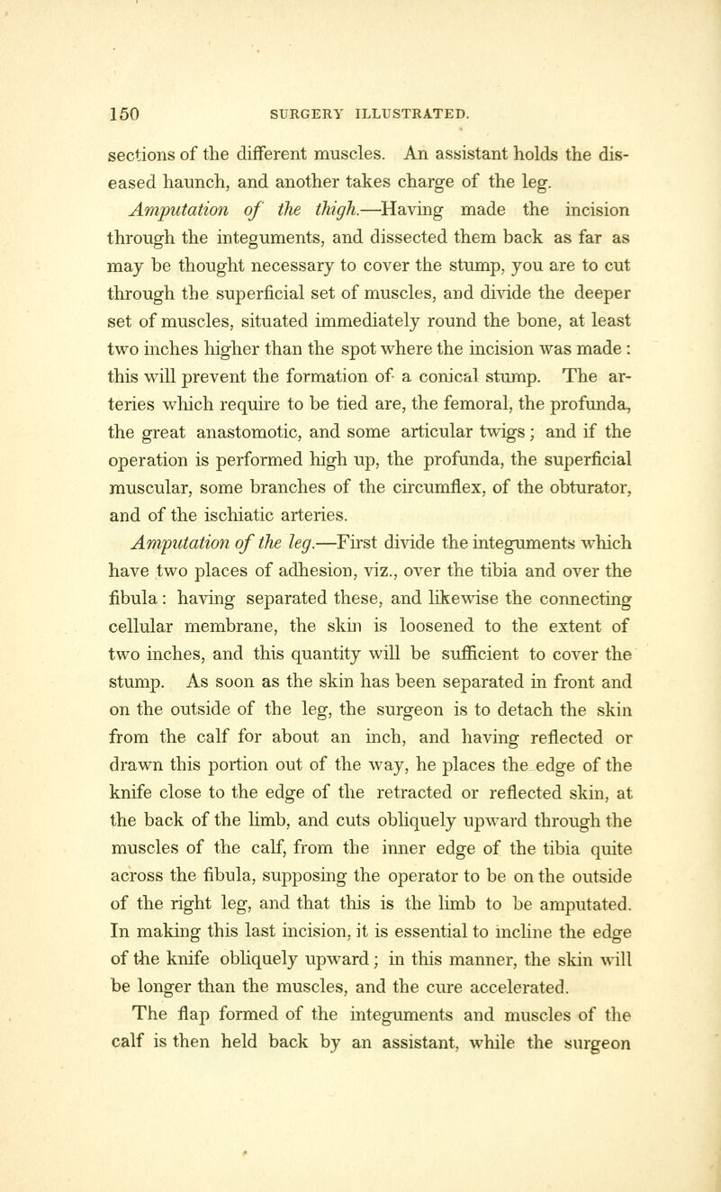 sections of the different muscles. An assistant holds the dis- eased haunch, and another takes charge of the leg. Amputation of the thigh.—Having made the incision through the integuments, and dissected them back as far as may be thought necessary to cover the stump, you are to cut through the superficial set of muscles, and divide the deeper set of muscles, situated immediately round the bone, at least two inches higher than the spot where the incision was made : this will prevent the formation of a conical stump. The ar- teries which require to be tied are, the femoral, the profunda, the great anastomotic, and some articular twigs; and if the operation is performed high up, the profunda, the superficial muscular, some branches of the circumflex, of the obturator, and of the ischiatic arteries. Amputation of the leg.—First divide the integuments which have two places of adhesion, viz., over the tibia and over the fibula: having separated these, and likewise the connecting cellular membrane, the skin is loosened to the extent of two inches, and this quantity will be sufficient to cover the stump. As soon as the skin has been separated in front and on the outside of the leg, the surgeon is to detach the skin from the calf for about an inch, and having reflected or drawn this portion out of the way, he places the edge of the knife close to the edge of the retracted or reflected skin, at the back of the limb, and cuts obliquely upward through the muscles of the calf, from the inner edge of the tibia quite across the fibula, supposing the operator to be on the outside of the right leg, and that this is the limb to be amputated. In making this last incision, it is essential to incline the edge of the knife obliquely upward; in this manner, the skin will be longer than the muscles, and the cure accelerated. The flap formed of the integuments and muscles of the calf is then held back by an assistant, while the surgeon