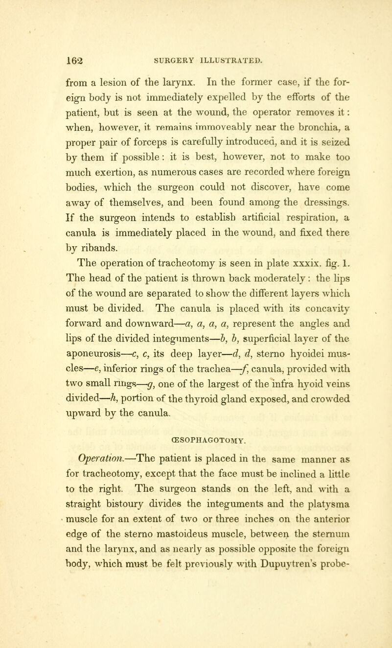 from a lesion of the larynx. In the former case, if the for- eign body is not immediately expelled by the efforts of the patient, but is seen at the wound, the operator removes it: when, however, it remains immoveably near the bronchia, a proper pair of forceps is carefully introduced, and it is seized by them if possible: it is best, however, not to make too much exertion, as numerous cases are recorded where foreign bodies, which the surgeon could not discover, have come away of themselves, and been found among the dressings. If the surgeon intends to establish artificial respiration, a canula is immediately placed in the wound, and fixed there by ribands. The operation of tracheotomy is seen in plate xxxix. fig. 1. The head of the patient is thrown back moderately : the lips of the wound are separated to show the different layers which must be divided. The canula is placed with its concavity forward and downward—a, a, a, a, represent the angles and lips of the divided integuments—b, b, superficial layer of the aponeurosis—c, c, its deep layer—d, d, sterno hyoidei mus- cles—e, inferior rings of the trachea—-f, canula, provided with two small rings—g, one of the largest of the infra hyoid veins divided—h, portion of the thyroid gland exposed, and crowded upward by the canula. CESOPHAGOTOMY. Operation.—The patient is placed in the same manner as for tracheotomy, except that the face must be inclined a little to the right. The surgeon stands on the left, and with a straight bistoury divides the integuments and the platysma muscle for an extent of two or three inches on the anterior edge of the sterno mastoideus muscle, between the sternum and the larynx, and as nearly as possible opposite the foreign body, which must be felt previously with Dupuytren's probe-