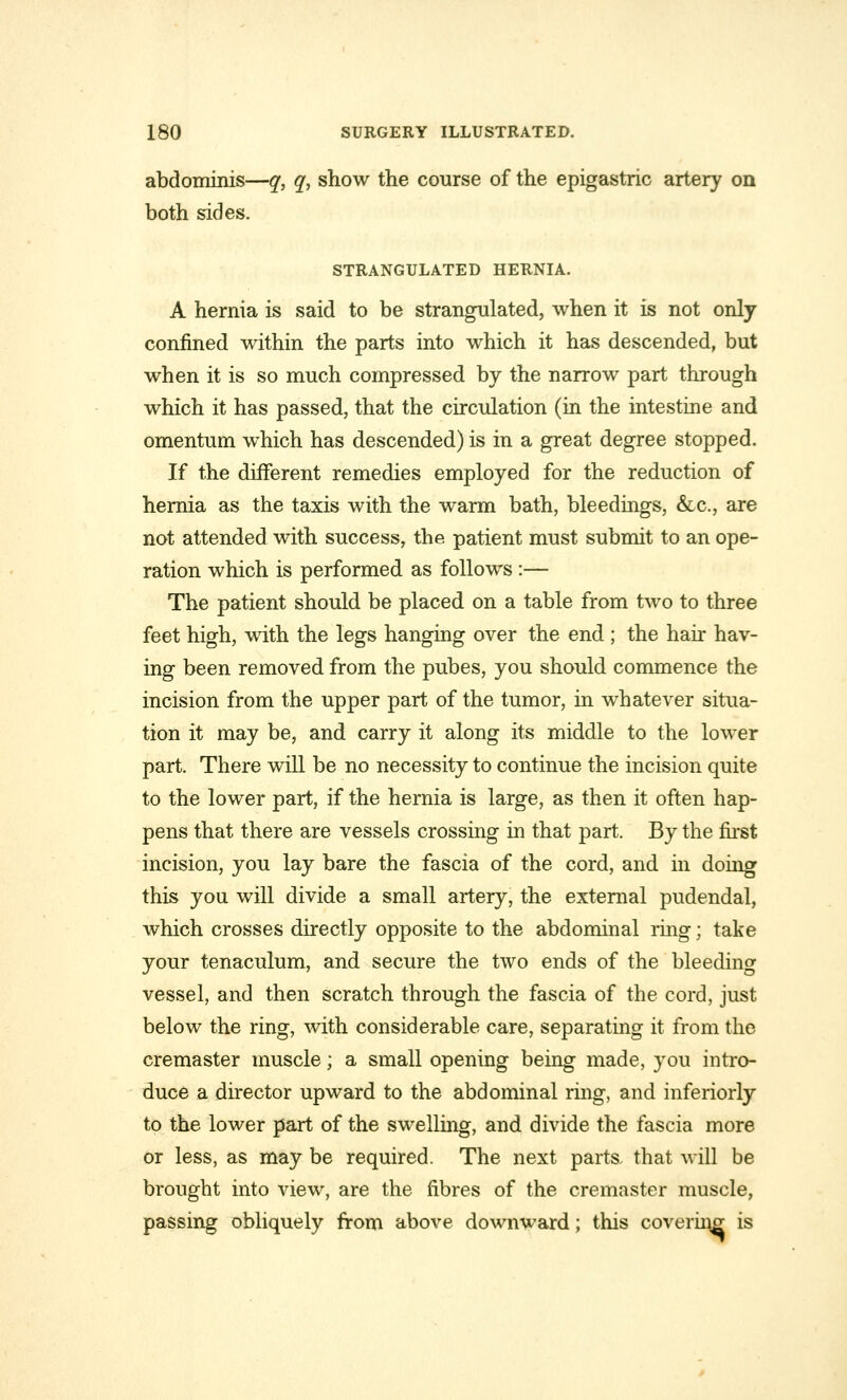 abdominis—q, q, show the course of the epigastric artery on both sides. STRANGULATED HERNIA. A hernia is said to be strangulated, when it is not only confined within the parts into which it has descended, but when it is so much compressed by the narrow part through which it has passed, that the circulation (in the intestine and omentum which has descended) is in a great degree stopped. If the different remedies employed for the reduction of hernia as the taxis with the warm bath, bleedings, &c, are not attended with success, the patient must submit to an ope- ration which is performed as follows :— The patient should be placed on a table from two to three feet high, with the legs hanging over the end ; the hair hav- ing been removed from the pubes, you should commence the incision from the upper part of the tumor, in whatever situa- tion it may be, and carry it along its middle to the lower part. There will be no necessity to continue the incision quite to the lower part, if the hernia is large, as then it often hap- pens that there are vessels crossing in that part. By the first incision, you lay bare the fascia of the cord, and in doing this you will divide a small artery, the external pudendal, which crosses directly opposite to the abdominal ring; take your tenaculum, and secure the two ends of the bleeding vessel, and then scratch through the fascia of the cord, just below the ring, with considerable care, separating it from the cremaster muscle; a small opening being made, you intro- duce a director upward to the abdominal ring, and inferiorly to the lower part of the swelling, and divide the fascia more or less, as may be required. The next parts, that will be brought into view, are the fibres of the cremaster muscle, passing obliquely from above downward; this covering is