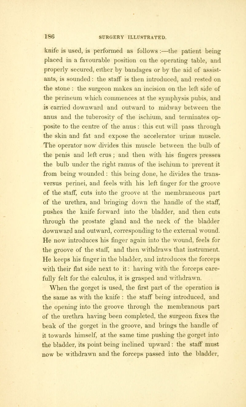 knife is used, is performed as follows :—the patient being placed in a favourable position on the operating table, and properly secured, either by bandages or by the aid of assist- ants, is sounded: the staff is then introduced, and rested on the stone : the surgeon makes an incision on the left side of the perineum which commences at the symphysis pubis, and is carried downward and outward to midway between the anus and the tuberosity of the ischium, and terminates op- posite to the centre of the anus : this cut will pass through the skin and fat and expose the accelerator urinae muscle. The operator now divides this muscle between the bulb of the penis and left crus; and then with his fingers presses the bulb under the right ramus of the ischium to prevent it from being wounded : this being done, he divides the trans- versa perinei, and feels with his left finger for the groove of the staff, cuts into the groove at the membraneous part of the urethra, and bringing down the handle of the staff, pushes the knife forward into the bladder, and then cuts through the prostate gland and the neck of the bladder downward and outward, corresponding to the external wound. He now introduces his finger again into the wound, feels for the groove of the staff, and then withdraws that instrument. He keeps his finger in the bladder, and introduces the forceps with their flat side next to it: having with the forceps care- fully felt for the calculus, it is grasped and withdrawn. When the gorget is used, the first part of the operation is the same as with the knife : the staff being introduced, and the opening into the groove through the membranous part of the urethra having been completed, the surgeon fixes the beak of the gorget in the groove, and brings the handle of it towards himself, at the same time pushing the gorget into the bladder, its point being inclined upward : the staff must now be withdrawn! and the forceps passed into the bladder,