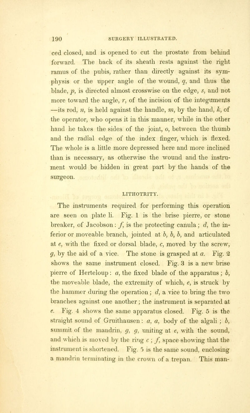 ced closed, and is opened to cut the prostate from behind forward. The back of its sheath rests against the right ramus of the pubis, rather than directly against its sym- physis or the upper angle of the wound, q, and thus the blade, p, is directed almost crosswise on the edge, s, and not more toward the angle, r, of the incision of the integuments —its rod, n, is held against the handle, m, by the hand, k, of the operator, who opens it in this manner, while in the other hand he takes the sides of the joint, o, between the thumb and the radial edge of the index finger, which is flexed. The whole is a little more depressed here and more inclined than is necessary, as otherwise the wound and the instru- ment would be bidden in great part by the hands of the surgeon. LITHOTRITY. The instruments required for performing this operation are seen on plate li. Fig. 1 is the brise pierre, or stone breaker, of Jacobson: f, is the protecting canula; d, the in- ferior or moveable branch, jointed at b, b, b, and articulated at e, with the fixed or dorsal blade, c, moved by the screw, g, by the aid of a vice. The stone is grasped at a. Fig. 2 shows the same instrument closed. Fig. 3 is a new brise pierre of Herteloup: a, the fixed blade of the apparatus ; b, the moveable blade, the extremity of which, e, is struck by the hammer during the operation; d, a vice to bring the two branches against one another; the instrument is separated at e. Fig. 4 shows the same apparatus closed. Fig. 5 is the straight sound of Gruithausen: a, a, body of the algali ; b, summit of the mandrill, g, g, uniting at e, with the sound, and which is moved by the ring c ; f, space showing that the instrument is shortened. Fig. 5 is the same sound, enclosing a mandrin terminating in the crown of a trepan. This man-