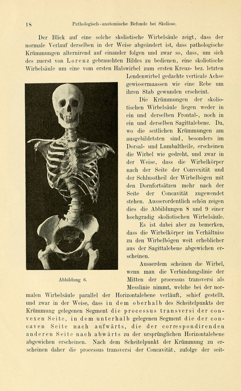 Der Blick auf eine solche skoliotische Wirbelsäule zeigt, dass der normale Verlauf derselben in der Weise abgeändert ist, dass pathologische Krümmungen alternirend auf einander folgen und zwar so, dass, um sich des zuerst von Lorenz gebrauchten Bildes zu bedienen, eine skoliotische Wirbelsäule um eine vom ersten Halswirbel zum ersten Kreuz- bez. letzten Lendenwirbel gedachte verticale Achse gewissermaassen wie eine Rebe um ihren Stab gewunden erscheint. Die Krümmungen der skolio- tischen Wirbelsäule liegen weder in ein und derselben Frontal-, noch in ein und derselben Sagittalebene. Da, wo die seitlichen Krümmungen am ausgebildetsten sind, besonders im Dorsal- und Lumbaltheile, erscheinen die Wirbel wie gedreht, und zwar in der Weise, dass die Wirbelkörper nach der Seite der Convexität und der Schlusstheil der Wirbelbögen mit den Dornfortsätzen mehr nach der Seite der Concavität zugewendet stehen. Ausserordentlich schön zeigen dies die Abbildungen 8 und 9 einer hochgradig skoliotischen Wirbelsäule. Es ist dabei aber zu bemerken, dass die Wirbelkörper im Verhältniss zu den Wirbelbögen weit erheblicher aus der Sagittalebene abgewichen er- scheinen. Ausserdem scheinen die Wirbel, wenn man die Verbindungslinie der Messlinie nimmt, welche bei der nor- malen Wirbelsäule parallel der Horizontalebene verläuft, schief gestellt, und zwar in der Weise, dass in dem oberhalb des Scheitelpunkts der Krümmung gelegenen Segment die processus transversi der con- vexen Seite, in dem unterhalb gelegenen Segment die der con- caven Seite nach aufwärts, die der correspondirenden anderen Seite nach abwärts zu der ursprünglichen Horizontalebene abgewichen erscheinen. Nach dem Scheitelpunkt der Krümmung zu er- scheinen daher die processus transversi der Concavität, zufolge der seit-