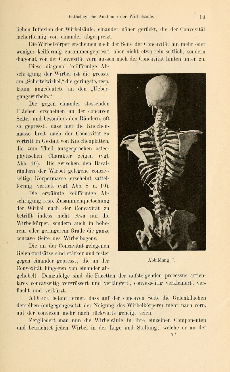 liehen Intlexion der Wirbelsäule, einander näher gerückt, die der Cunvexität fächerförmig von einander abgespreizt. Die Wirbelkörper erscheinen nach der Seite der Concavität hin mehr oder weniger keilförmig zusammengepresst, aber nicht etwa rein seitlich, sondern diagonal, von der Convexität vorn aussen nach der Concavität hinten unten zu. Diese diagonal keilförmige Ab- schrägung der Wirbel ist die grösste am „Scheitelwirbel, die geringste, resp. kaum angedeutete an den „Ueber- gangswirbeln. Die gegen einander stossenden Flächen erscheinen an der coneaven Seite, und besonders den Eändern, oft so gepresst, dass hier die Knochen- masse breit nach der Concavität zu vortritt in Gestalt von Knochenplatten, die zum Theil ausgesprochen osteo- plastischen Charakter zeigen (vgl. Abb. 10). Die zwischen den Basal- rändern der Wirbel gelegene coneav- seitige Körpermasse erscheint sattel- förmig vertieft (vgl. Abb. 8 u. 19). Die erwähnte keilförmige Ab- schrägung resp. Zusammenquetschung der Wirbel nach der Concavität zu betrifft indess nicht etwa nur die Wirbelkörper, sondern auch in höhe- rem oder geringerem Grade die ganze coneave Seite des Wirbelbogens. Die an der Concavität gelegenen Gelenkfortsätze sind stärker und fester Convexität hingegen von einander ab- gehebelt. Demzufolge sind die Facetten der aufsteigenden processus articu- lares coneavseitig vergrössert und verlängert, convexseitig verkleinert, ver- flacht und verkürzt. Albert betont ferner, dass auf der coneaven Seite die Gelenkflächen derselben (entgegengesetzt der Neigung des Wirbelkörpers) mehr nach vorn, auf der convexen mehr nach rückwärts geneigt seien. Zergliedert man nun die Wirbelsäule in ihre einzelnen Componenten und betrachtet jeden Wirbel in der Lage und Stellung, welche er an der 2*