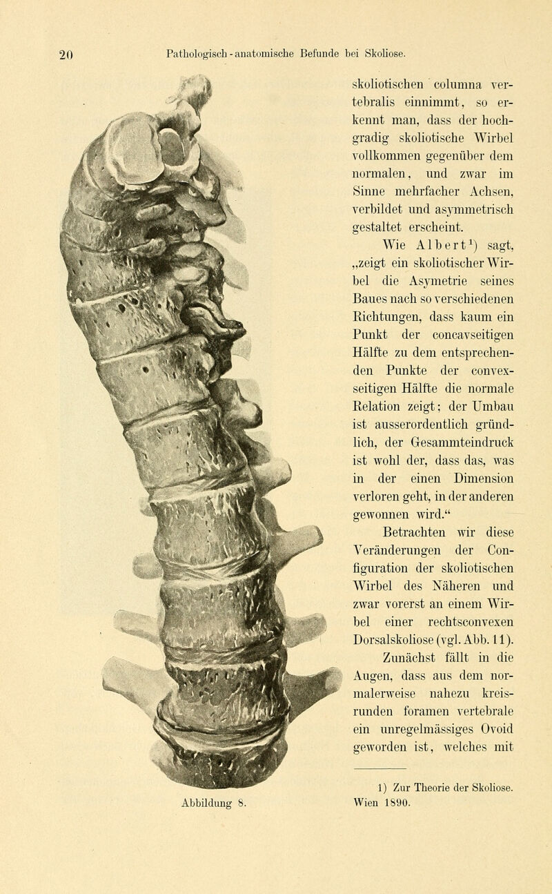 skoliotischen columna ver- tebralis einnimmt, so er- kennt man, dass der hoch- gradig skoliotische Wirbel vollkommen gegenüber dem normalen, und zwar im Sinne mehrfacher Achsen, verbildet und asymmetrisch gestaltet erscheint. Wie Albert1) sagt, „zeigt ein skoliotischer Wir- bel die Asvmetrie seines Baues nach so verschiedenen Richtungen, dass kaum ein Punkt der concavseitigen Hälfte zu dem entsprechen- den Punkte der convex- seitigen Hälfte die normale Relation zeigt; der Umbau ist ausserordentlich gründ- lich, der G-esammteindruck ist wohl der, dass das, was in der einen Dimension verloren geht, in der anderen gewonnen wird. Betrachten wir diese Yeränderungen der Con- figuration der skoliotischen Wirbel des Näheren und zwar vorerst an einem Wir- bel einer rechtsconvexen Dorsalskoliose (vgl. Abb. 11). Zunächst fällt in die Augen, dass aus dem nor- malerweise nahezu kreis- runden foramen vertebrale ein unregelmässiges Ovoid geworden ist, welches mit Abbildung 8. 1) Zur Theorie der Skoliose. Wien 1890.