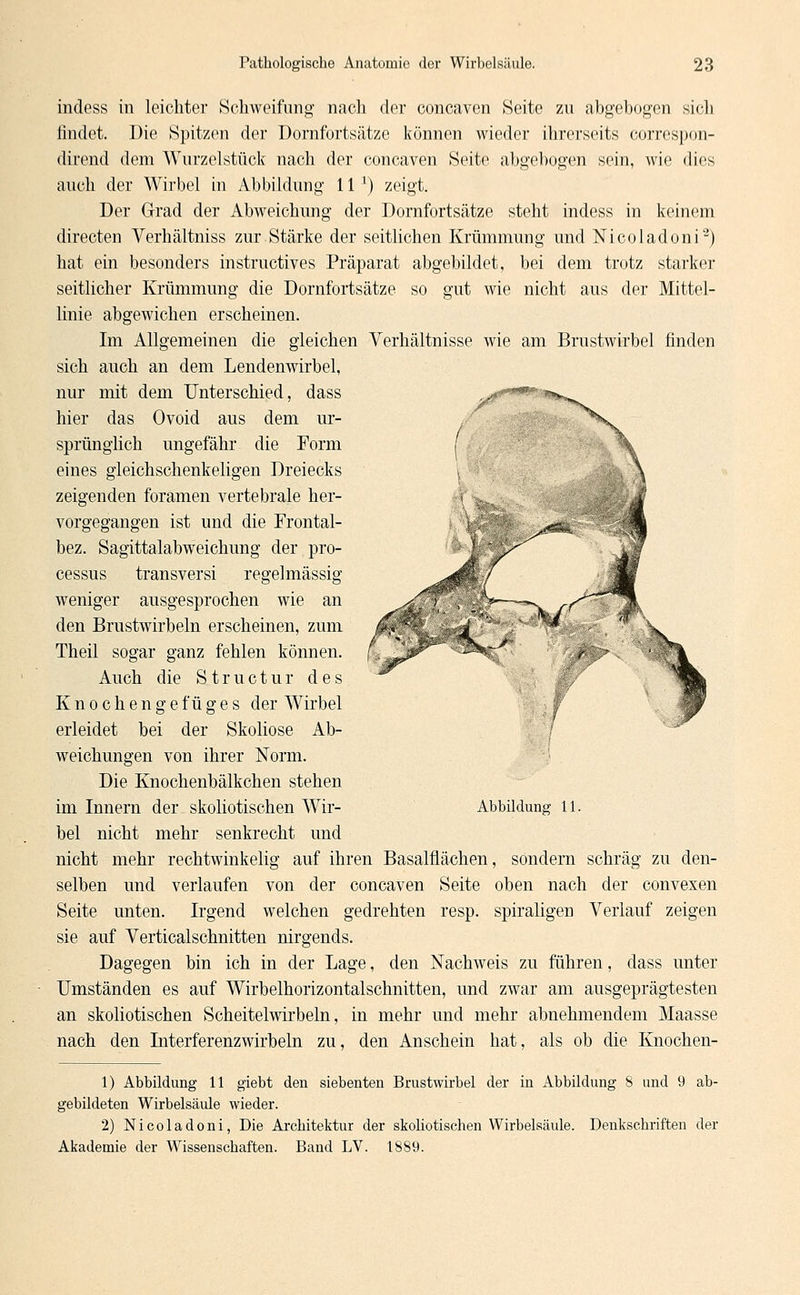 indess in leichter Schweifung nach der concaven Seite zu abgebogen sieb findet. Die Spitzen der Dornfortsätze können wieder ihrerseits correspon- dirend dem Wurzelstück nach der concaven Seite abgebogen sein, wie dies auch der Wirbel in Abbildung 11 ') zeigt. Der Grad der Abweichung der Dornfortsätze steht indess in keinem directen Verhältniss zur Stärke der seitlichen Krümmung und Nicoladon i'2) hat ein besonders instructives Präparat abgebildet, bei dem trotz starker seitlicher Krümmung die Dornfortsätze so gut wie nicht aus der Mittel- linie abgewichen erscheinen. Im Allgemeinen die gleichen Verhältnisse wie am Brustwirbel finden sich auch an dem Lendenwirbel, nur mit dem Unterschied, dass hier das Ovoid aus dem ur- sprünglich ungefähr die Form eines gleichschenkeligen Dreiecks zeigenden foramen vertebrale her- vorgegangen ist und die Frontal- bez. Sagittalabweichung der Pro- cessus transversi regelmässig weniger ausgesprochen wie an den Brustwirbeln erscheinen, zum Theil sogar ganz fehlen können. Auch die Structur des Knochengefüges der Wirbel erleidet bei der Skoliose Ab- weichungen von ihrer Norm. Die Knochenbälkchen stehen im Innern der skoliotischen Wir- bel nicht mehr senkrecht und nicht mehr rechtwinkelig auf ihren Basalflächen, sondern schräg zu den- selben und verlaufen von der concaven Seite oben nach der convexen Seite unten. Irgend welchen gedrehten resp. spiraligen Verlauf zeigen sie auf Verticalschnitten nirgends. Dagegen bin ich in der Lage, den Nachweis zu führen, dass unter Umständen es auf Wirbelhorizontalschnitten, und zwar am ausgeprägtesten an skoliotischen Scheitelwirbeln, in mehr und mehr abnehmendem Maasse nach den Interferenzwirbeln zu, den Anschein hat, als ob die Knochen- <v Abbildung 11, 1) Abbildung 11 giebt den siebenten Brustwirbel der in Abbildung 8 und 9 ab- gebildeten Wirbelsäule wieder. 2) Nicoladoni, Die Architektur der skoliotischen Wirbelsäule. Denkschriften der Akademie der Wissenschaften. Band LV. 1889.