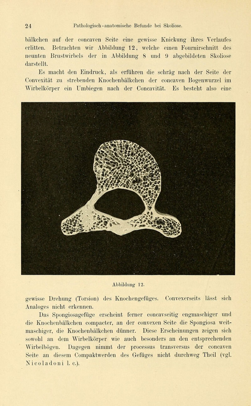 bälkchen auf der concaven Seite eine gewisse Knickung ihres Verlaufes erlitten. Betrachten wir Abbildung 12, welche einen Fournirschnitt des neunten Brustwirbels der in Abbildung 8 und 9 abgebildeten Skoliose darstellt. Es macht den Eindruck, als erführen die schräg nach der Seite der Convexität zu strebenden Knochenbälkchen der concaven Bogenwurzel im Wirbelkörper ein Umbiegen nach der Concavität. Es besteht also eine Abbildung 12. gewisse Drehung (Torsion) des Knochengefüges. Convexerseits lässt sich Analoges nicht erkennen. Das Spongiosagefüge erscheint ferner concavseitig engmaschiger und die Knochenbälkchen compacter, an der convexen Seite die Spongiosa weit- maschiger, die Knochenbälkchen dünner. Diese Erscheinungen zeigen sich sowohl an dem Wirbelkörper wie auch besonders an den entsprechenden Wirbelbögen. Dagegen nimmt der processus transversus der concaven Seite an diesem Compaktwerden des Gefüges nicht durchweg Theil (vgl. Nico lad oni 1. c).