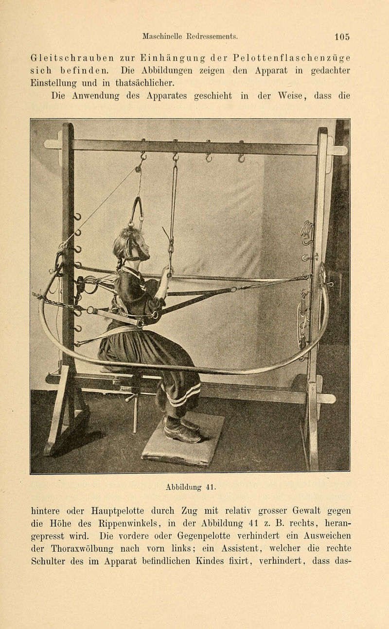 Gleitschrauben zur Einhängung der Pelottenflaschenzüge sich befinden. Die Abbildungen zeigen den Apparat in gedachter Einstellung und in thatsächlicher. Die Anwendung des Apparates geschieht in der Weise, dass die Abbildung 41. hintere oder Hauptpelotte durch Zug mit relativ grosser Gewalt gegen die Höhe des Eippenwinkeis, in der Abbildung 41 z. B. rechts, heran- gepresst wird. Die vordere oder Gegenpelotte verhindert ein Ausweichen der Thoraxwölbung nach vorn links; ein Assistent, welcher die rechte Schulter des im Apparat befindlichen Kindes fixirt, verhindert, dass das-