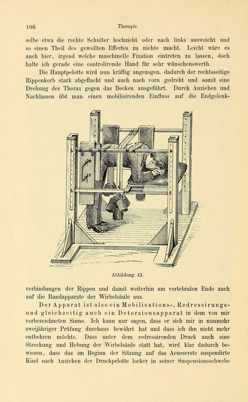selbe etwa die rechte Schulter hochzieht oder nach links ausweicht und so einen Theil des gewollten Effectes zu nichte macht. Leicht wäre es auch hier, irgend welche maschinelle Fixation eintreten zu lassen, doch halte ich gerade eine controlirende Hand für sehr wünschenswerth. Die Hauptpelotte wird nun kräftig angezogen, dadurch der rechtsseitige Bippenkorb stark abgeflacht und auch nach vorn gedreht und somit eine Drehung des Thorax gegen das Becken ausgeführt. Durch Anziehen und Nachlassen übt man einen mobilisirenden Einfluss auf die Endgelenk- Abbildung 42. Verbindungen der Bippen und damit weiterhin am vertebralen Ende auch auf die Bandapparate der Wirbelsäule aus. Der Apparat ist also ein Mobilisations-, Bedressirungs- und gleichzeitig auch ein Detorsionsapparat in dem von mir vorbezeichneten Sinne. Ich kann nur sagen, dass er sich mir in nunmehr zweijähriger Prüfung durchaus bewährt hat und dass ich ihn nicht mehr entbehren möchte. Dass unter dem redressirenden Druck auch eine Streckung und Hebung der Wirbelsäule statt hat, wird klar dadurch be- wiesen, dass das im Beginn der Sitzung auf das Aeusserste suspendirte Kind nach Anziehen der Druckpelotte locker in seiner Suspensionsschwebe