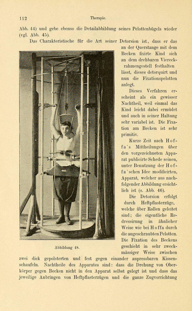 Abb. 44) und gebe ebenso die Detailabbildung seines Pelottenbügels wieder (vgl. Abb. 45). Das Charakteristische für die Art seiner Detorsion ist, dass er das an der Querstange mit dem Becken fixirte Kind sich an dem drehbaren Viereck- rahmengestell festhalten lässt, dieses detorquirt und nun die Fixationspelotten anlegt. Dieses Verfahren er- scheint als ein gewisser Nachtheil, weil einmal das Kind leicht dabei ermüdet und auch in seiner Haltung sehr variabel ist. Die Fixa- tion am Becken ist sehr primitiv. Kurze Zeit nach Hof- fa's Mittheilungen über den vorgezeichneten Appa- rat publicirte Schede seinen, unter Benutzung der Hof- fa'sehen Idee modificirten, Apparat, welcher aus nach- folgender Abbildung ersicht- lich ist (s. Abb. 46). Die Detorsion erfolgt durch Heftpflasterzüge, welche über Rollen geleitet sind; die eigentliche Re- dressirung in ähnlicher Weise wie bei H o ffa durch die angeschraubten Pelotten. Die Fixation des Beckens geschieht in sehr zweck- mässiger Weise zwischen zwei dick gepolsterten und fest gegen einander anpressbaren Kissen- schaufeln. Nachtheile des Apparates sind: dass die Drehung von Ober- körper gegen Becken nicht in den Apparat selbst gelegt ist und dass das jeweilige Anbringen von Heftpfiasterzügen und die ganze Zugvorrichtung