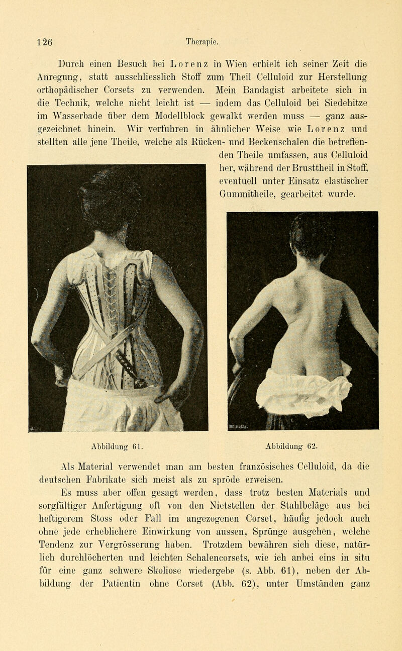 Durch einen Besuch bei Lorenz in Wien erhielt ich seiner Zeit die Anregung, statt ausschliesslich Stoff zum Theil Celluloid zur Herstellung orthopädischer Corsets zu verwenden. Mein Bandagist arbeitete sich in die Technik, welche nicht leicht ist — indem das Celluloid bei Siedehitze im Wasserbade über dem Modellblock gewalkt werden muss — ganz aus- gezeichnet hinein. Wir verfuhren in ähnlicher Weise wie Lorenz und stellten alle jene Theile, welche als Bücken- und Beckenschalen die betreffen- den Theile umfassen, aus Celluloid her, während der Brusttheil in Stoff, eventuell unter Einsatz elastischer Gnmmitheile, gearbeitet wurde. Abbildung 61. Abbildung 62. Als Material verwendet man am besten französisches Celluloid, da die deutschen Fabrikate sich meist als zu spröde erweisen. Es muss aber offen gesagt werden, dass trotz besten Materials und sorgfältiger Anfertigung oft von den Nietstellen der Stahlbeläge aus bei heftigerem Stoss oder Fall im angezogenen Corset, häufig jedoch auch ohne jede erheblichere Einwirkung von aussen, Sprünge ausgehen, welche Tendenz zur Vergrösserung haben. Trotzdem bewähren sich diese, natür- lich durchlöcherten und leichten Schalencorsets, wie ich anbei eins in situ für eine ganz schwere Skoliose wiedergebe (s. Abb. 61), neben der Ab- bildung der Patientin ohne Corset (Abb. 62), unter Umständen ganz