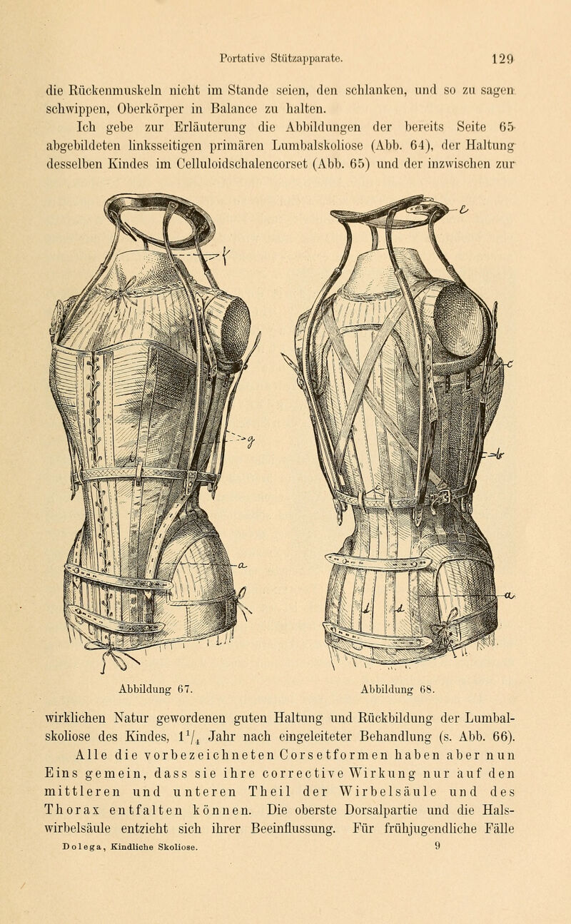 die Rückenmuskeln nicht im Stande seien, den schlanken, und so zu sagen schwippen, Oberkörper in Balance zu halten. Ich gebe zur Erläuterung die Abbildungen der bereits Seite 65 abgebildeten linksseitigen primären Lumbaiskoliose (Abb. 64), der Haltung desselben Kindes im Celluloidschalencorset (Abb. 65) und der inzwischen zur Abbildung 67. Abbildung 68. wirklichen Natur gewordenen guten Haltung und Rückbildung der Lumbai- skoliose des Kindes, l1/^ Jahr nach eingeleiteter Behandlung (s. Abb. 66). Alle die vorbezeichneten Corsetformen haben aber nun Eins gemein, dass sie ihre corrective Wirkung nur auf den mittleren und unteren Theil der Wirbelsäule und des Thorax entfalten können. Die oberste Dorsalpartie und die Hals- wirbelsäule entzieht sich ihrer Beeinflussung. Für frühjugendliche Fälle Dolega, Kindliche Skoliose. 9