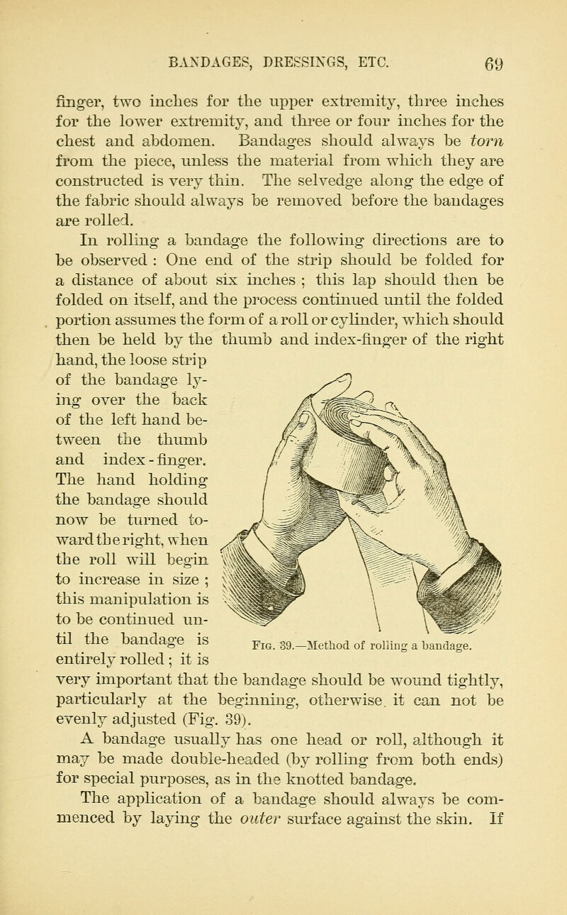 finger, two inches for the upper extremity, three inches for the lower extremity, and three or four inches for the chest and abdomen. Bandages should always be torn from the piece, unless the material from which they are constructed is very thin. The selvedge along the edge of the fabric should always be removed before the bandages are rolled. In rolling a bandage the following du'ections are to be observed : One end of the strip should be folded for a distance of about six inches ; this lap should then be folded on itself, and the x^rocess continued until the folded portion assumes the form of a roll or cylinder, which should then be held by the thumb and index-finger of the right hand, the loose strip of the bandage ly- ing over the back of the left hand be- tween the thumb and index - finger. The hand holding the bandage should now be turned to- ward the right, when the roll will begin to increase in size ; this manipulation is to be continued un- til the bandage is entirely rolled ; it is very important that the bandage should be wound tightly, particularly at the beginning, otherwise, it can not be evenly adjusted (Fig. 39). A bandage usually has one head or roll, although it may be made double-headed (by rolling from both ends) for special purposes, as in the knotted bandage. The application of a bandage should always be com- menced by laying the outer sm^face against the skin. If Fig. 39.—Method of rolling a bandage.