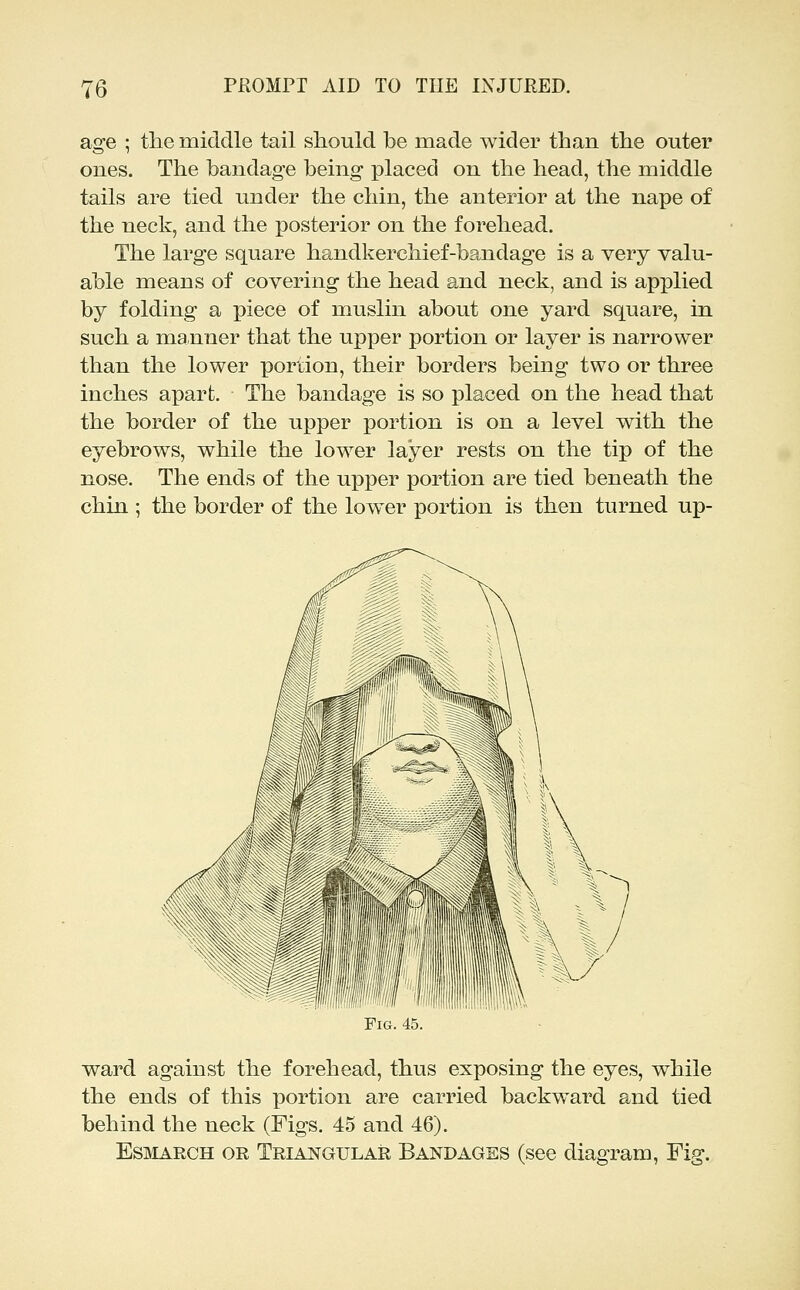 age ; the middle tail should be made wider than the outer ones. The bandage being placed on the head, the middle tails are tied under the chin, the anterior at the nape of the neck, and the posterior on the forehead. The large square handkerchief-bandage is a very valu- able means of covering the head and neck, and is applied by folding a piece of muslin about one yard square, in such a manner that the upper portion or layer is narrower than the lower portion, their borders being two or three inches apart. The bandage is so placed on the head that the border of the upper portion is on a level with the eyebrows, while the lower layer rests on the tip of the nose. The ends of the upper portion are tied beneath the chin ; the border of the low^er portion is then turned up- FiG. 45. ward against the forehead, thus exposing the eyes, while the ends of this portion are carried backward and tied behind the neck (Figs. 45 and 46). EsMARCH OR Triangular Bandages (see diagram, Fig.