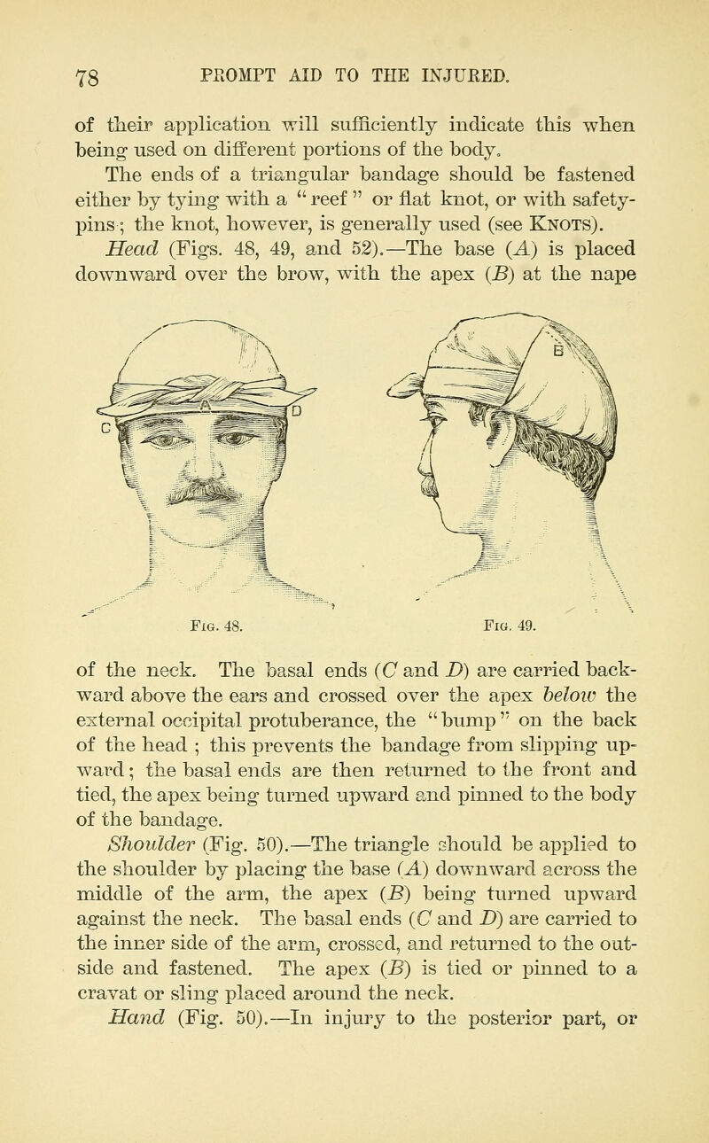 of their application will sufficiently indicate this when being used on different portions of the body. The ends of a triangular bandage should be fastened either by tying with a  reef  or fiat knot, or with safety- pins ; the knot, however, is generally used (see Knots). Head (Figs. 48, 49, and 52).—The base {A) is placed downward over the brow, with the apex {B) at the nape Fig. 48. Fig. 49. of the neck. The basal ends {C and D) are carried back- ward above the ears and crossed over the apex beloiv the external occipital protuberance, the  bump' on the back of the head ; this prevents the bandage from slipping up- ward ; the basal ends are then returned to the front and tied, the apex being turned upward and pinned to the body of the bandage. Shoulder (Fig. 50).—The triangle should be applied to the shoulder by placing the base (A) downward across the middle of the arm, the apex (B) being turned upward against the neck. The basal ends (O and D) are carried to the inner side of the arm, crossed, and returned to the out- side and fastened. The apex (B) is tied or pinned to a cravat or sling placed around the neck. Hand (Fig. 50).—In injury to the posterior part, or