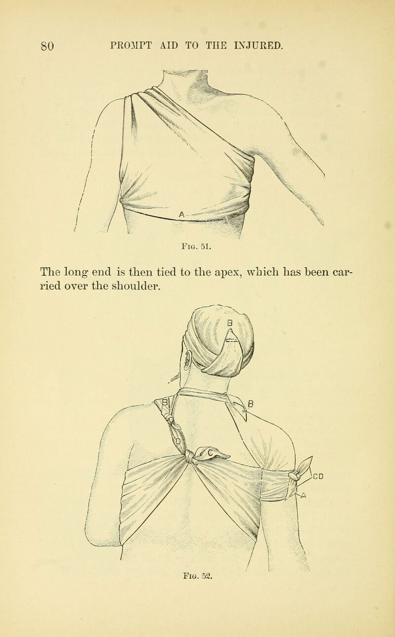 Fig. 51. The long end is then tied to the apex, which has been car- ried over the shoulder.