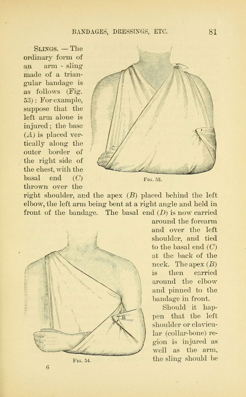 Fig. 53. Slings. — The orcliiiai'y form of an arm - sling made of a trian- gular bandage is as follows (Fig. 53): For example, suppose that the left arm alone is injured; the base (A) is placed ver- tically along the outer border of the right side of the chest, with the basal end (C) thrown over the right shoulder, and the apex (B) placed behind the left elbow, the left arm being bent at a right angle and held in front of the bandage. The basal end (D) is now carried around the forearm V , and over the left ' ^ shoulder, and tied ,/' to the basal end (C) ^r^'^ ^ at the back of the neck. The apex {B) is then carried around the elbow and pinned to the bandage in front. Should it hap- pen that the left shoulder or clavicu- lar (coliar-bone) re- gion is injured as well as the arm, Fig. 54. the sling should be