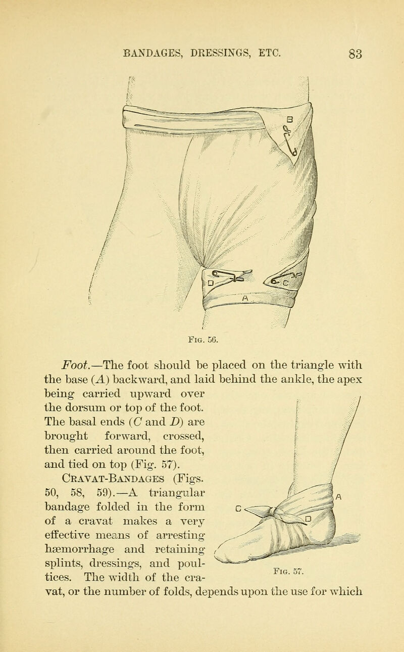 Fig. Foot.—The foot should be placed on the triangle with the base {A) backward, and laid behind the ankle, the apex being carried upward over the dorsum or top of the foot. The basal ends (O and D) are brought forward, crossed, then carried around the foot, and tied on top (Fig. 57). Crayat-Bandages (Figs. 50, 58, 59).—A triangular bandage folded in the form of a cravat makes a very effective means of arresting haemorrhage and retaining splints, dressings, and poul- tices. The width of the cra- vat, or the number of folds, depends upon the use for which