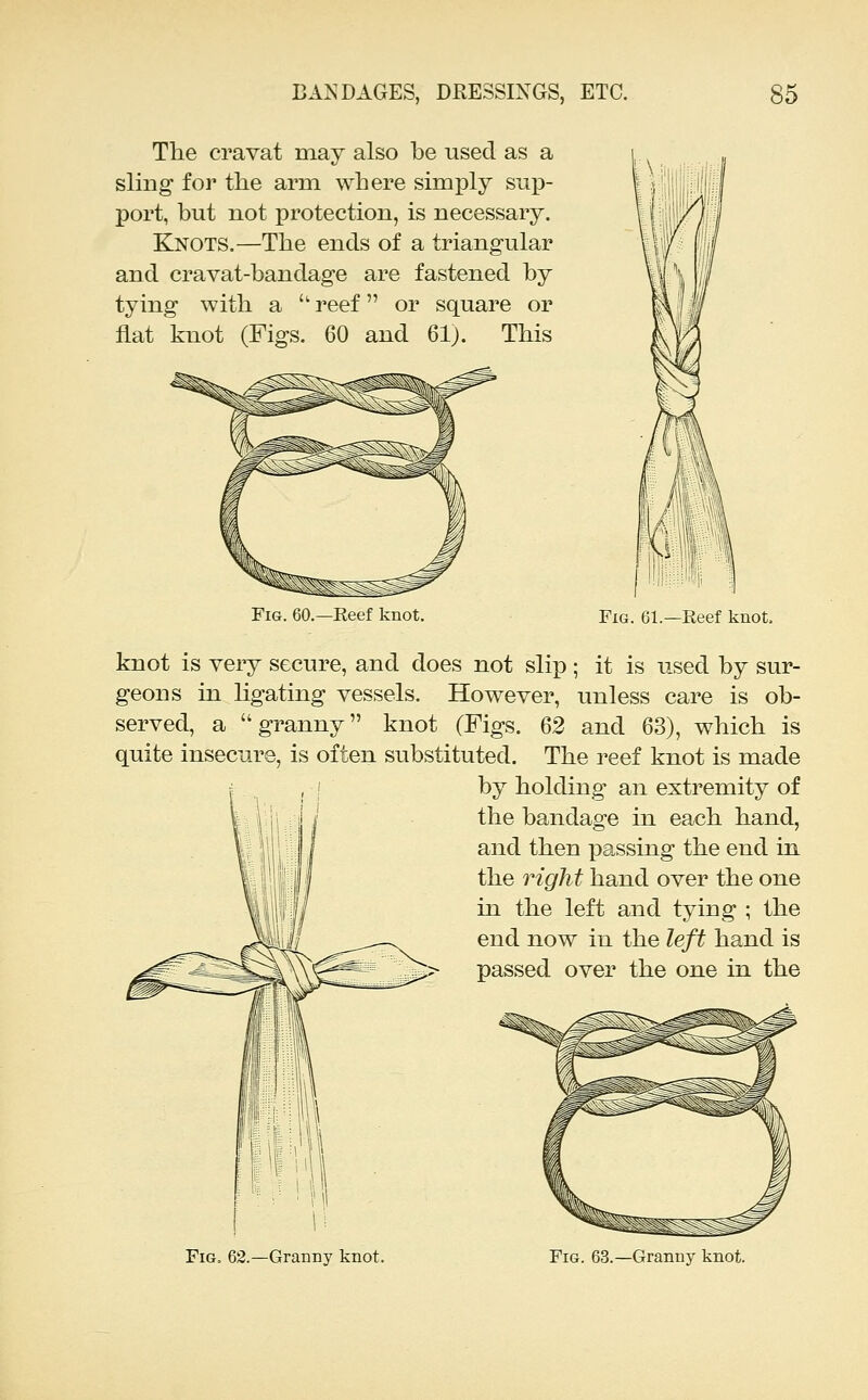 The cravat may also be used as a sling for the arm where simply sup- port, but not protection, is necessary. Ejnots.—The ends of a triangular and cravat-bandage are fastened by tying with a  reef or square or flat knot (Figs. 60 and 61). This XI Fig. 60.—Eeef knot. Fig. 61.—Eeef knot. knot is very secure, and does not slip ; it is used by sur- geons in Hgating vessels. However, unless care is ob- served, a granny knot (Figs. 62 and 63), which is quite insecure, is often substituted. The reef knot is made by holding an extremity of the bandage in each hand, and then passing the end in the right hand over the one in the left and tying ; the end now in the left hand is passed over the one in the Fig. 62.—Granny knot. Fig. 63.—Granny knot.