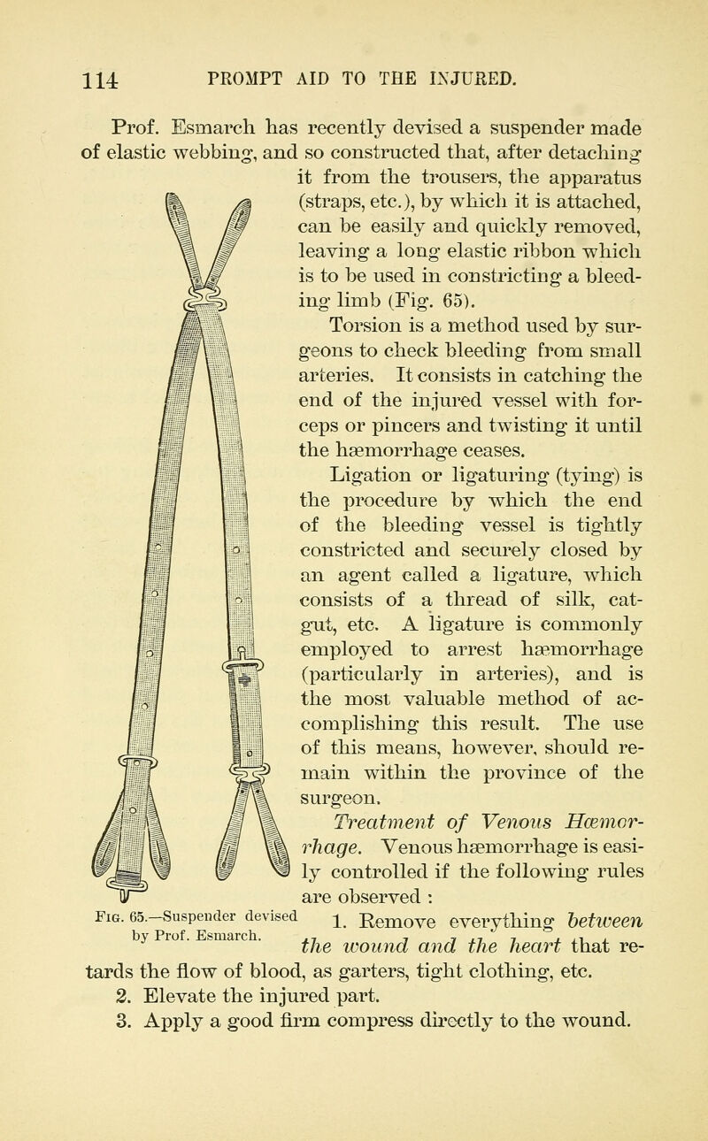 Prof. Esmarch has recently devised a suspender made of elastic webbing, and so constructed that, after detaching it from the trousers, the apparatus (straps, etc.), by which it is attached, can be easily and quickly removed, leaving a long elastic ribbon which is to be used in constricting a bleed- ing limb (Fig. 65). Torsion is a method used by sur- geons to check bleeding from small arteries. It consists in catching the end of the injured vessel with for- ceps or pincers and twisting it until the haemorrhage ceases. Ligation or ligaturing (tying) is the procedure by which the end of the bleeding vessel is tightly constricted and secui^ely closed by an agent called a ligature, which consists of a thread of silk, cat- gut, etc, A ligature is commonly employed to arrest ha?morrhage (particularly in arteries), and is the most valuable method of ac- complishing this result. The use of this means, however, should re- main within the province of the surgeon. Treatment of Venous Hoenior- rhage. Venous haemorrhage is easi- ly controlled if the following rules are observed : Fig. 65.-Suspender devised ^ Eemove everything between y ro . smarc . ^j^^ wound and the heart that re- tards the flow of blood, as garters, tight clothing, etc. 2. Elevate the injured part. 3. Apply a good fu^m compress directly to the wound.