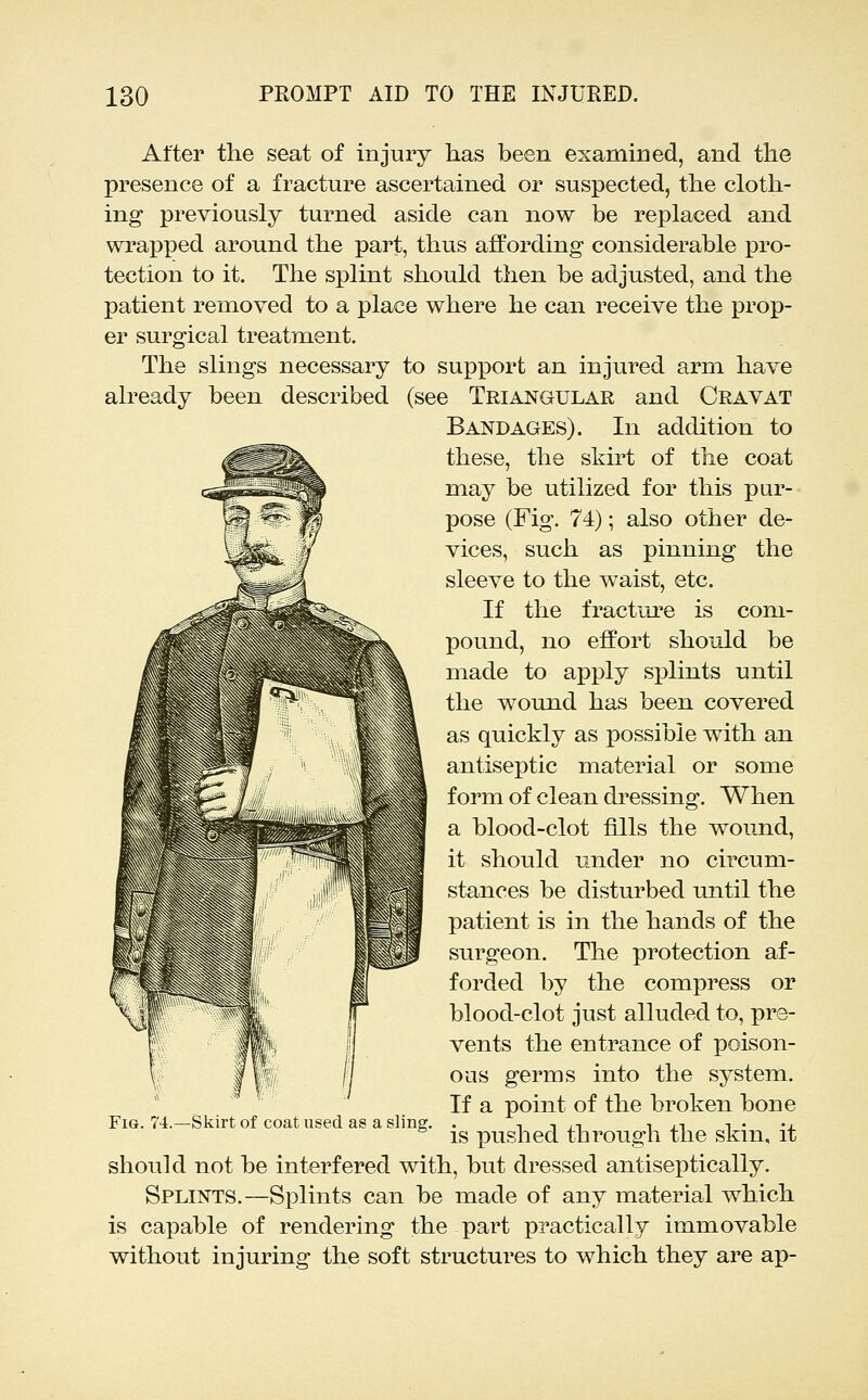 After the seat of injury has been examined, and the presence of a fracture ascertained or suspected, the cloth- ing previously turned aside can now be replaced and wrapped around the part, thus affording considerable pro- tection to it. The splint should then be adjusted, and the patient removed to a place where he can receive the prop- er surgical treatment. The slings necessary to support an injured arm have already been described (see Triangular and Cravat Bandages). In addition to these, the skirt of the coat may be utilized for this pur- pose (Fig. 74); also other de- vices, such as pinning the sleeve to the waist, etc. If the fractui'e is com- pound, no effort should be made to apply splints until the wound has been covered as quickly as possible with an antiseptic material or some form of clean dressing. When a blood-clot fills the wound, it should under no circum- stances be disturbed until the patient is in the hands of the surgeon. The protection af- forded by the compress or blood-clot just alluded to, pre- vents the entrance of poison- ous germs into the system. If a point of the broken bone is pushed through the skin, it should not be interfered with, but dressed antiseptically. Splints.—Si3lints can be made of any material which is capable of rendering the part practically immovable without injuring the soft structures to which they are ap- FiG. 74.—Skirt of coat used as a sling.