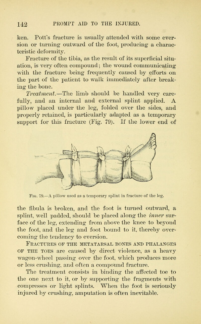 ken. Pott's fracture is usually attended with some ever- sion or turning outward of the foot, producing a charac- teristic deformity. Fracture of the tibia, as the result of its superficial situ- ation, is very often compound; the wound communicating with the fracture being frequently caused by eiforts on the part of the patient to walk immediately after break- ing the bone. Treatmeiit.—The limb should be handled very care- fully, and an internal and external splint applied. A pillow placed under the leg, folded over the sides, and properly retained, is particularly adapted as a temporary support for this fracture (Fig. 79). If the lower end of Fig. 79.—a pillow used as a temporary splint in fracture of the leg. the fibula is broken, and the foot is turned outward, a splint, well padded, should be placed along the inner sur- face of the leg, extending from above the knee to beyond the foot, and the leg and foot bound to it, thereby over- coming the tendency to eversion. Fractures of the metatarsal bones and phalanges OF THE TOES are caused by direct violence, as a heavy wagon-wheel passing over the foot, which produces more or less crushing, and often a compound fracture. The treatment consists in binding the affected toe to the one next to it, or by supporting the fragments with compresses or light splints. When the foot is seriously injured by crushing, amputation is often inevitable.