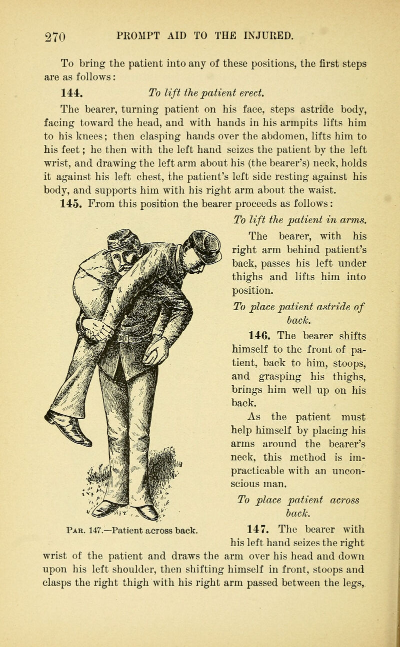 To bring the patient into any of these positions, the first steps are as follows: 144, To lift the patient erect. The bearer, turning patient on his face, steps astride body, facing toward the head, and with hands in his armpits lifts him to his knees; then clasping hands over the abdomen, lifts him to his feet; he then with the left hand seizes the patient by the left wrist, and drawing the left arm about his (the bearer's) neck, holds it against his left chest, the patient's left side resting against his body, and supports him with his right arm about the waist. 145. From this position the bearer proceeds as follows: To lift the patient in arms. The bearer, with his right arm behind patient's back, passes his left under thighs and lifts him into position. To place patient astride of bach. 146. The bearer shifts himself to the front of pa- tient, back to him, stoops, and grasping his thighs, brings him well up on his back. As the patient must help himself by placing his arms around the bearer's neck, this method is im- practicable with an uncon- scious man. To place patient across lack. Par. 147—Patient across back, 147. The bearer with his left hand seizes the right wrist of the patient and draws the arm over his head and down upon his left shoulder, then shifting himself in front, stoops and clasps the right thigh with his right arm passed between the legs,