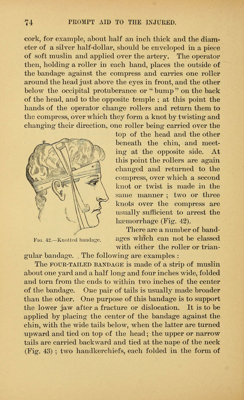 cork, for example, about half an inch thick and the diam- eter of a silver half-dollar, should be enveloped in a piece of soft muslin and applied over the artery. The operator then, holding a roller in each hand, places the outside of the bandage against the compress and carries one roller around the head just above the eyes in front, and the other below the occipital protuberance or  bump  on the back of the head, and to the opposite temple ; at this point the hands of the operator change rollers and return them to the compress, over which they form a knot by twisting and changing their direction, one roller being carried over the top of the head and the other beneath the chin, and meet- ing at the opposite side. At this point the rollers are again changed and returned to the compress, over which a second knot or twist is made in the same manner ; two or three knots over the compress are usually sufficient to arrest the haemorrhage (Fig. 42). There are a number of band- ages which can not be classed with either the roller or trian- gular bandage. . The following are examples : The four-tailed bandage is made of a strip of muslin about one yard and a half long and four inches wide, folded and torn from the ends to within two inches of the center of the bandage. One pair of tails is usually made broader than the other. One purpose of this bandage is to support the lower jaw after a fracture or dislocation. It is to be applied by placing the center of the bandage against the chin, with the wide tails below, when the latter are turned upward and tied on top of the head; the upper or narrow tails are carried backward and tied at the nape of the neck Fig. 42.— Knotted bandage.