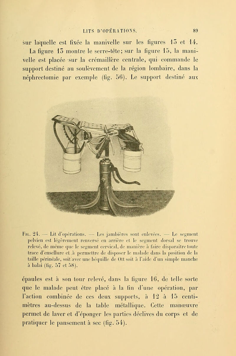 sur laquelle est fixée la manivelle sur les figures 15 et 14. La figure 15 montre le serre-tête; sur la figure 15, la mani- velle est placée sur la crémaillère centrale, qui commande le support destiné au soulèvement de la région lombaire, dans la néphrectomie par exemple (fig. 56). Le support destiné aux FiG. 24. — Lit d'opérations. — Les jambières sont enlevées. — Le sef;nient pelvien est légèrement renversé en arrière et le segment dorsal se trouve relevé, de même que le segment cervical, de manière à l'aire disparaître toute trace d'ensellure et .à permettre de disposer le malade dans la position de la taille périnéale, soifavcc une béquille de Oit soit à l'aide d'un simple manche à balai (iig. 57 et î^^). épaules est à son tour relevé, dans la figure 16, de telle sorte que le malade peut être placé à la fin d'une opération, par l'action combinée de ces deux supports, à 12 à 15 centi- mètres au-dessus de la table métallique. Cette manœuvre permet de laver et d'éponger les parties déclives du corps et de pratiquer le pansement à sec (fig. 54).