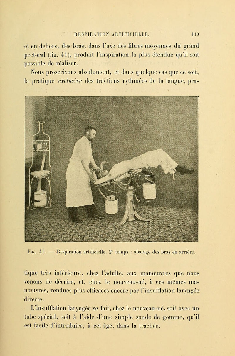 et en dehors, des bras, dans l'axe des fibres moyennes du grand pectoral (fig. 41), produit l'inspiration la plus étendue qu'il soit possible de réaliser. Nous proscrivons absolument, et dans quelque cas que ce soit, la pratique exclusive des tractions rythmées de la langue, pra- t'iG. 41. — Piespiriilion ;irlificielle. '2 temps : abatage des bras en arrière. tique très inférieure, chez l'adulte, aux manœuvres que nous venons de décrire, et, chez le nouveau-né, à ces mêmes ma- nœuvres, rendues plus efficaces encore par l'insufflation laryngée directe. L'insufflation laryngée se fait, chez le nouveau-né, soit avec un tube spécial, soit à l'aide d'une simple sonde de gomme, qu'il est facile d'introduire, à cet âge, dans la trachée.