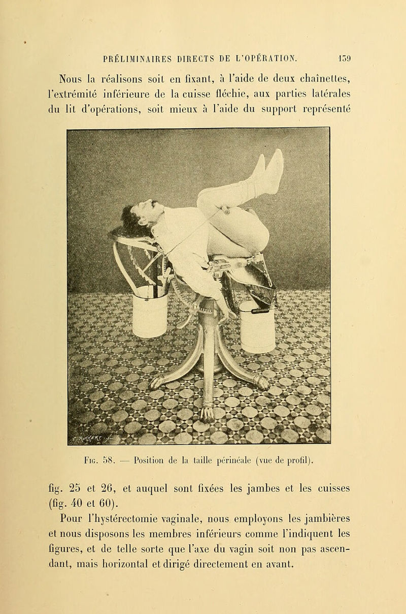 Nous la réalisons soil en fixant, à l'aide de deux chaînettes, l'extrémité inférieure de la cuisse fléchie, aux parties latérales du lit d'opérations, soit mieux à l'aide du support représenté FiG. 58. — Position de la taille périnéale (vue de profil). %. 25 et 26, et auquel sont fixées les jambes et les cuisses (fig. 40 et 60). Pour l'hystérectomie vaginale, nous employons les jambières et nous disposons les membres inférieurs comme l'indiquent les figures, et de telle sorte que l'axe du vagin soit non pas ascen- dant, mais horizontal et dirigé directement en avant.