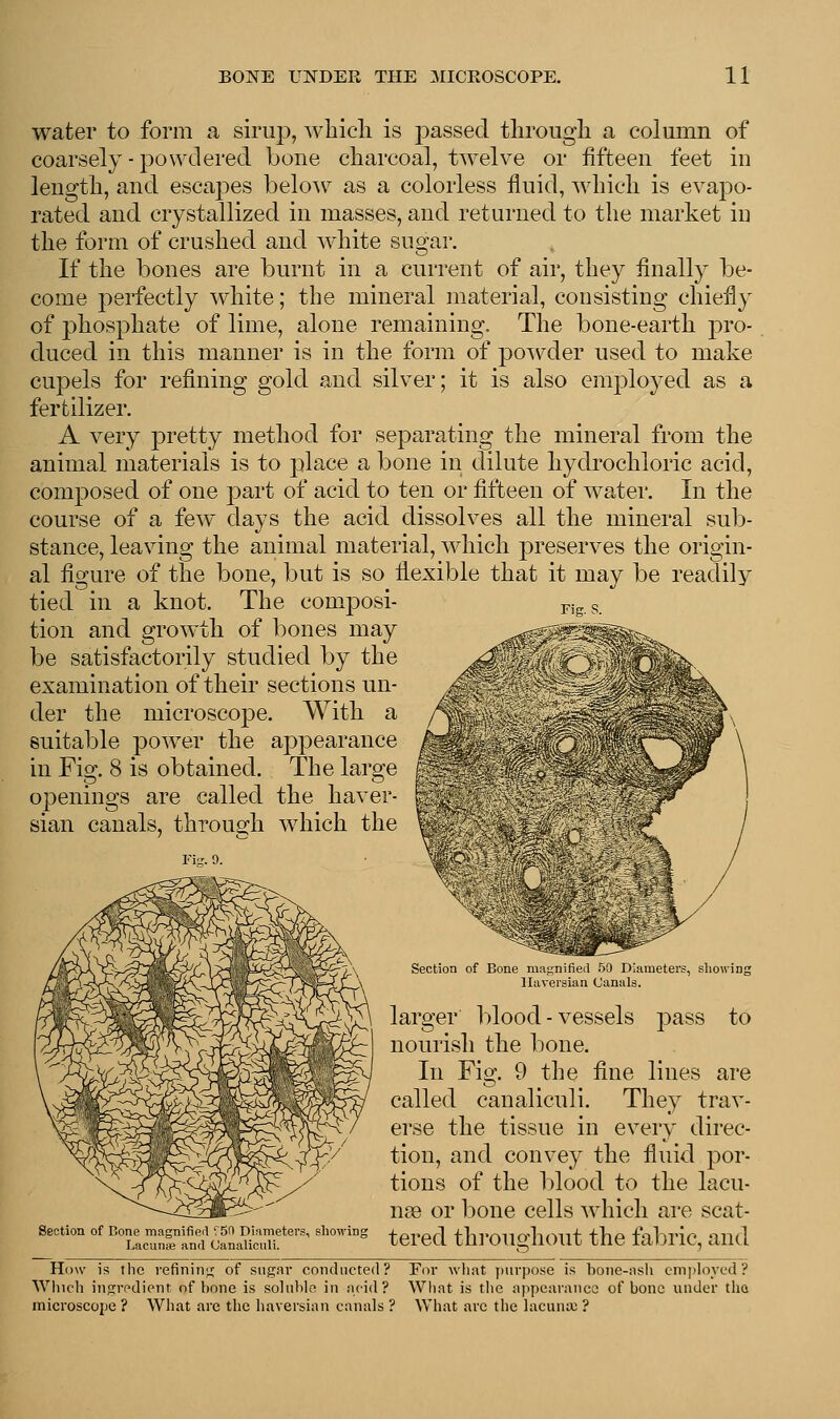 water to form a sirup, which is passed through a column of coarsely - powdered bone charcoal, twelve or fifteen feet in length, and escaj)es below as a colorless fluid, which is evapo- rated and crystallized in masses, and returned to the market in the form of crushed and white sugar. If the bones are burnt in a current of air, they finally be- come perfectly white; the mineral material, consisting chiefly of phosphate of lime, alone remaining. The bone-earth pro- duced in this manner is in the form of powder used to make cupels for refining gold and silver; it is also employed as a fertilizer. A very pretty method for separating the mineral from the animal materials is to place a bone in dilute hydrochloric acid, composed of one part of acid to ten or fifteen of water. In the course of a few days the acid dissolves all the mineral sub- stance, leaving the animal material, which preserves the origin- al figure of the bone, but is so flexible that it may be readily tied in a knot. The composi- tion and growth of bones may be satisfactorily studied by the examination of their sections un- der the microscope. With a suitable power the appearance in Fig. 8 is obtained. The large openings are called the haver- sian canals, through which the Fig. S. Section of Bone magnified '50 Diameters, showing Lacunae and Canaliculi. Section of Bone magnified 50 Diameters, showing Haversian Canals. larger blood-vessels pass to nourish the bone. In Fig. 9 the fine lines are called canaliculi. They trav- erse the tissue in every direc- tion, and convey the fluid por- tions of the blood to the lacu- nse or bone cells which are scat- tered throughout the fabric, and How is the refining of sugar conducted? For what purpose is bone-ash employed? Which ingredient of bone is soluble in acid? What is the appearance of bone under the microscope ? What are the haversian canals ? What arc the lacuna; ?