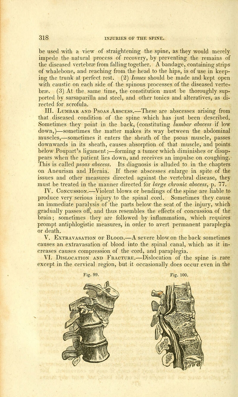 be used with a view of straightening the spine, as they would merely impede the natural process of recovery, by preventing the remains of the diseased vertebrae from falling together. A bandage, containing strips of whalebone, and reaching from the head to the hips, is of use in keep- ing the trunk at perfect rest. (2) Issues should be made and kept open with caustic on each side of the spinous processes of the diseased verte- brae. (3) At the same time, the constitution must be thoroughly sup- ported by sarsaparilla and steel, and other tonics and alteratives, as di- rected for scrofula. III. Lumbar and Psoas Abscess.—These are abscesses arising from that diseased condition of the spine which has just been described. Sometimes they point in the back, (constituting lumbar abscess if low down,)—sometimes the matter makes its way between the abdominal muscles,—sometimes it enters the sheath of the psoas muscle, passes downwards in its sheath, causes absorption of that muscle, and points below Poupart's ligament;—forming a tumor which diminishes or disap- pears when the patient lies down, and receives an impulse on coughing. This is called psoas abscess. Its diagnosis is alluded to in the chapters on Aneurism and Hernia. If these abscesses enlarge in spite of the issues and other measures directed against the vertebral disease, they must be treated in the manner directed for large chronic abscess, p. 77. rV. Concussion.—Violent blows or bendings of the spine are liable to produce very serious injury to the spinal cord. Sometimes they cause an immediate paralysis of the parts below the seat of the injury, w^hich gradually passes off, and thus resembles the effects of concussion of the brain; sometimes they are followed by inflammation, which requires prompt antiphlogistic measures, in order to avert permanent paraplegia or death. V. Extravasation of Blood.—A severe blow on the back sometimes causes an extravasation of blood into the spinal canal, which as it in- creases causes compression of the cord, and paraplegia. VI. Dislocation and Fracture.—Dislocation of the spine is rare except in the cervical region, but it occasionally does occur even in the Fig. 99.