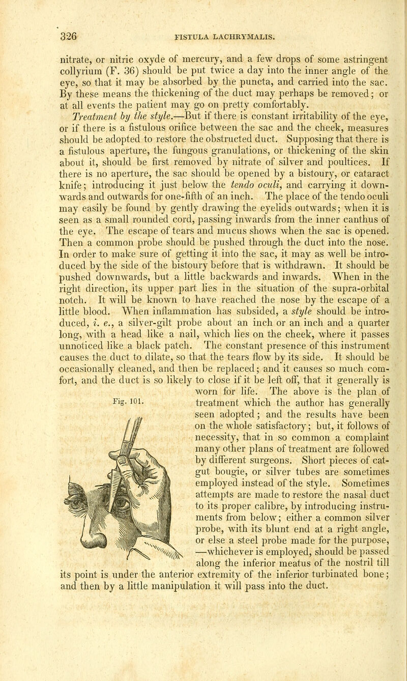 nitrate, or nitric oxyde of mercury, and a few drops of some astringent collyrium (F. 36) should be put twice a day into the inner angle of the eye, so that it may be absorbed by the puncta, and carried into the sac. By these means the thickening of the duct may perhaps be removed; or at all events the patient may go on pretty comfortably. Treatment by the style.—But if there is constant irritability of the eye, or if there is a fistulous orifice between the sac and the cheek, measures should be adopted to restore the obstructed duct. Supposing that there is a fistulous aperture, the fungous granulations, or thickening of the skin about it, should be first removed by nitrate of silver and poultices. If there is no aperture, the sac should be opened by a bistoury, or cataract knife; introducing it just below the tendo oculi, and carrying it down- wards and outwards for one-fifth of an inch. The place of the tendo oculi may easily be found by gently drawing the eyelids outwards; when it is seen as a small rounded cord, passing inwards from the inner canthus of the eye. The escape of tears and mucus shows when the sac is opened. Then a common probe should be pushed through the duct into the nose. In order to make sure of getting it into the sac, it may as well be intro- duced by the side of the bistoury before that is withdrawn. It should be pushed downwards, but a little backwards and inwards. When in the right direction, its upper part lies in the situation of the supra-orbital notch. It will be known to have reached the nose by the escape of a little blood. When inflammation has subsided, a style should be intro- duced, i. e., a silver-gilt probe about an inch or an inch and a quarter long, with a head like a nail, which lies on the cheek, where it passes unnoticed like a black patch. The constant presence of this instrument causes the duct to dilate, so that the tears flow by its side. It should be occasionally cleaned, and then be replaced; and it causes so much com- fort, and the duct is so likely to close if it be left off, that it generally is worn for life. The above is the plan of treatment which the author has generally seen adopted; and the results have been on the whole satisfactory; but, it follows of necessity, that in so common a complaint many other plans of treatment are followed by different surgeons. Short pieces of cat- gut bougie, or silver tubes are sometimes employed instead of the style. Sometimes attempts are made to restore the nasal duct to its proper calibre, by introducing instru- ments from below; either a common silver probe, with its blunt end at a right angle, or else a steel probe made for the purpose, —whichever is employed, should be passed along the inferior meatus of the nostril till its point is under the anterior extremity of the inferior turbinated bone; and then by a little manipulation it will pass into the duct. riff. 101.