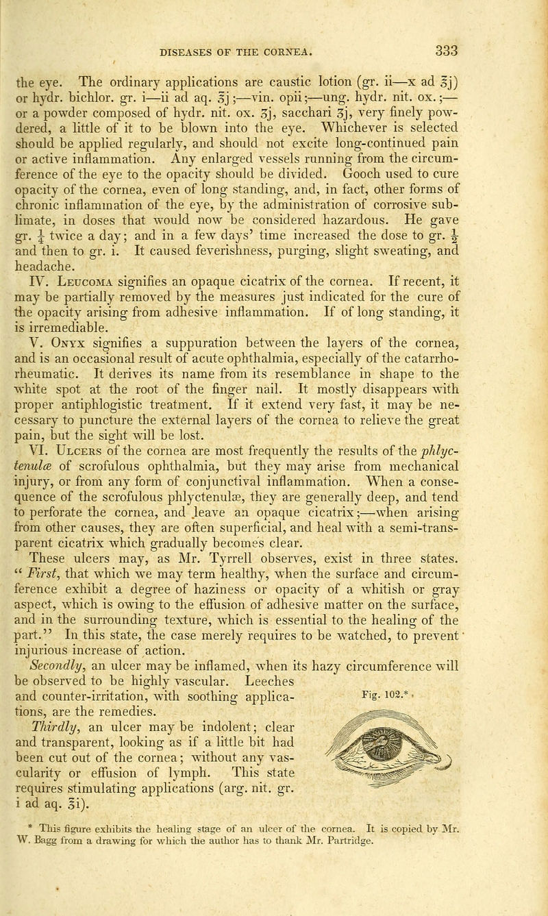 the eye. The ordinary applications are caustic lotion (gr. ii—x ad |j) or hydr. bichlor. gr. i—ii ad aq. 5j;—vin. opii;—ung. hydr. nit. ox.;— or a powder composed of hydr. nit. ox. 3j, sacchari 3j, very finely pow- dered, a little of it to be blown into the eye. Whichever is selected should be applied regularly, and should not excite long-continued pain or active inflammation. Any enlarged vessels running from the circum- ference of the eye to the opacity should be divided. Gooch used to cure opacity of the cornea, even of long standing, and, in fact, other forms of chronic inflammation of the eye, by the administration of corrosive sub- limate, in doses that would now be considered hazardous. He gave gr. ^ twice a day; and in a few days' time increased the dose to gr. ^ and then to gr. i. It caused feverishness, purging, slight sweating, and headache. IV. Leucoma signifies an opaque cicatrix of the cornea. If recent, it may be partially removed by the measures just indicated for the cure of the opacity arising from adhesive inflammation. If of long standing, it is irremediable. V. Onyx signifies a suppuration between the layers of the cornea, and is an occasional result of acute ophthalmia, especially of the catarrho- rheumatic. It derives its name from its resemblance in shape to the white spot at the root of the finger nail. It mostly disappears wdth proper antiphlogistic treatment. If it extend very fast, it may be ne- cessary to puncture the external layers of the cornea to relieve the great pain, but the sight will be lost. VI. Ulcers of the cornea are most frequently the results of the phlyc- tenulce of scrofulous ophthalmia, but they may arise from mechanical injury, or from any form of conjunctival inflammation. When a conse- quence of the scrofulous phlyctenute, they are generally deep, and tend to perforate the cornea, and .leave an opaque cicatrix;—when arising from other causes, they are often superficial, and heal with a semi-trans- parent cicatrix which gradually becomes clear. These ulcers may, as Mr. Tyrrell observes, exist in three states.  First, that which we may term healthy, when the surface and circum- ference exhibit a degree of haziness or opacity of a whitish or gray aspect, which is owing to the effusion of adhesive matter on the surface, and in the surrounding texture, which is essential to the healing of the part, In this state, the case merely requires to be w^atched, to prevent' injurious increase of action. Secondly, an ulcer may be inflamed, when its hazy circumference will be observed to be highly vascular. Leeches and counter-irritation, with soothing applica- tions, are the remedies. Thirdly, an ulcer may be indolent; clear and transparent, looking as if a little bit had been cut out of the cornea; without any vas- cularity or eflTusion of lymph. This state requires stimulating applications (arg. nit. gr. i ad aq. Ii). Fiff. 102.* * This figure exhibits the healing stage of an ulcer of the cornea. It is copied by Mr. W. Bagg from a drawing for which the author has to thank Mr. Partridge.