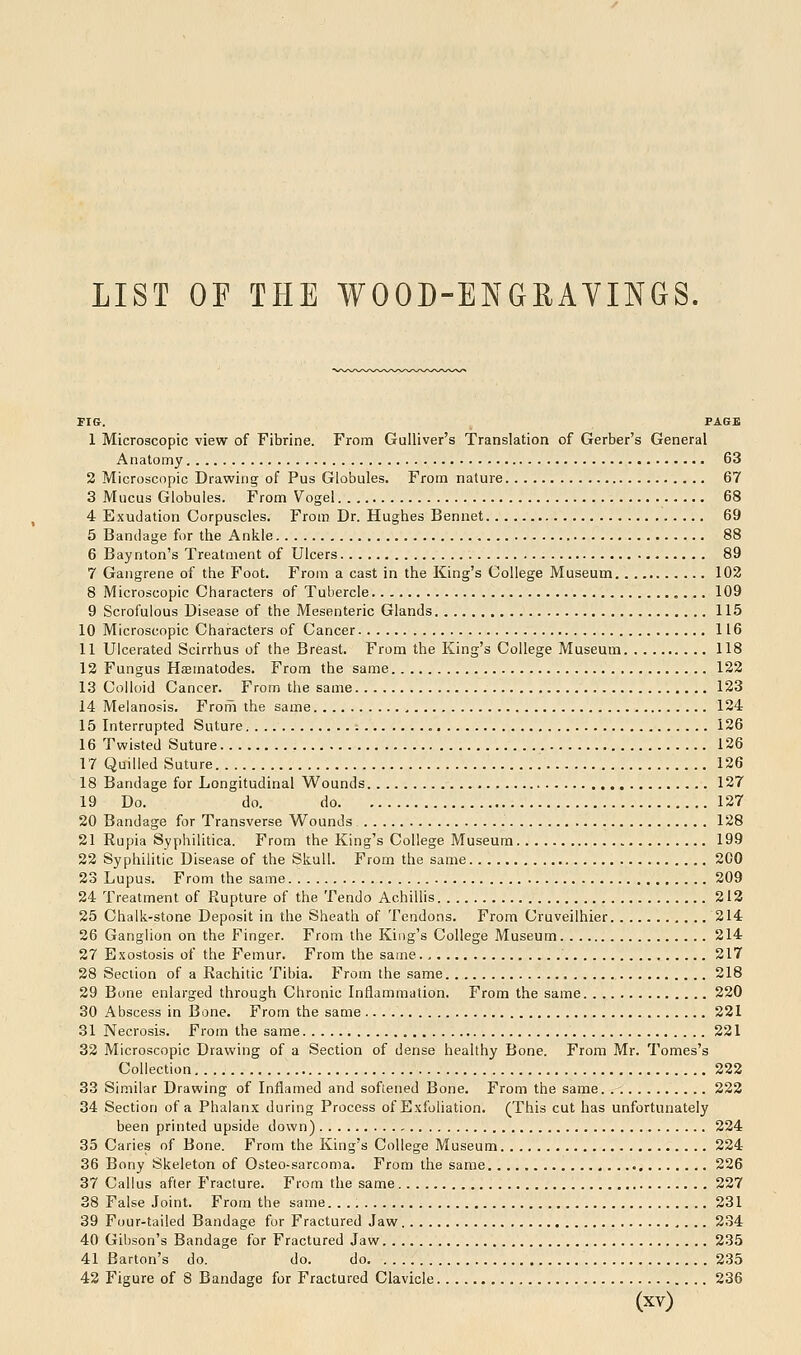 LIST OE THE WOOD-ENGEAYINGS. FI&. PAGE 1 Microscopic view of Fibrine. From Gulliver's Translation of Gerber's General Anatomy 63 2 Microscopic Drawing of Pus Globules. From nature 67 3 Mucus Globules. From Vogel 68 4 Exudation Corpuscles. From Dr. Hughes Bennet 69 5 Bandage for the Ankle 88 6 Baynton's Treatment of Ulcers 89 7 Gangrene of the Foot. From a cast in the King's College Museum 102 8 Microscopic Characters of Tubercle 109 9 Scrofulous Disease of the Mesenteric Glands 115 10 Microscopic Characters of Cancer 116 11 Ulcerated Scirrhus of the Breast. From the King's College Museum 118 12 Fungus Hsematodes. From the same 122 13 Colloid Cancer. From the same 123 14 Melanosis. From the same 124 15 Interrupted Suture 126 16 Twisted Suture 126 17 Quilled Suture 126 18 Bandage for Longitudinal Wounds 127 19 Do. do. do 127 20 Bandage for Transverse Wounds 128 21 Rupia Syphilitica. From the King's College Museum 199 22 Syphilitic Disease of the Skull. From the same 200 23 Lupus. From the same 209 24 Treatment of Rupture of the Tendo Achillis 212 25 Chalk-stone Deposit in the Sheath of Tendons. From Cruveilhier 214 26 Ganglion on the Finger. From the King's College Museum 214 27 Exostosis of the Femur. From the same 217 28 Section of a Rachitic Tibia. From the same , 218 29 Bone enlarged through Chronic Inflammation. From the same 220 30 Abscess in Bone. From the same 221 31 Necrosis. From the same 221 32 Microscopic Drawing of a Section of dense healthy Bone. From Mr. Tomes's Collection 222 33 Similar Drawing of Inflamed and softened Bone. From the same. . 222 34 Section of a Phalanx during Process of Exfoliation. (This cut has unfortunately been printed upside down) , 224 35 Caries of Bone. From the King's College Museum 224 36 Bony Skeleton of Osteo-sarcoma. From the same 226 37 Callus after Fracture. From the same 227 38 False Joint. From the same 231 39 Four-tailed Bandage for Fractured Jaw 234 40 Gibson's Bandage for Fractured Jaw 235 41 Barton's do. do. do 235 42 Figure of 8 Bandage for Fractured Clavicle 236