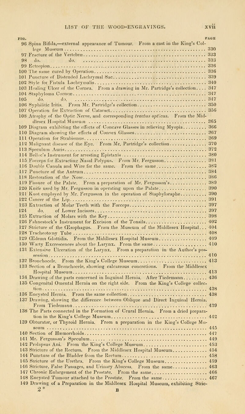 FIG. PAGE 96 Spina Bifida,—external appearance of Tumour. From a cast in the King's Col- lege Museum 330 97 Fracture of the Vertebras 333 98 do. do 333 99 Ectropion 336 100 The Slime cured by 0[)eralion 336 101 Puncture of Distended Lachrymal Sac 339 102 Style for Fistula Lachrymalis 340 103 Healing Ulcer of the Cornea. From a drawing in Mr. Partridge's collection. . .. 347 104 Staphyloma Cornese 347 105 do. do 347 106 Syphilitic Iritis. From Mr. Partridge's collection 350 107 Operation for Extraction of Cataract 356 108 Atrophy of the Optic Nerve, and corresponding tradus opticus. From the Mid- dlesex Hospital Museum 365 109 Diagram exhibiting the effects of Concave Glasses in relieving Myopia 366 110 Diagram showing the effects of Convex Glasses 367 111 Operation for Strabismus 369 112 Malignant disease of the Eye. From Mr. Partridge's collection 370 113 Speculum Auris 372 114 Belloc's Instrument for arresting Epistaxis 380 115 Forceps for Extracting Nasal Polypus. From Mr. Fergusson 331 116 Double Canula and Wire for the same. From the same 382 117 Puncture of the Antrum 384 118 Restoration of the Nose 386 119 Fissure of the Palate. From a preparation of Mr. Fergusson's 389 120 Knife used by Mr, Fergusson in operating upon the Palate 390 121 Knot employed by Mr. Fergusson in the operation of Stapbyloraphe 390 122 Cancer of the Lip 391 123 Extraction of Molar Teeth with the Forceps 397 124 do. of Lower Incisors 397 125 Extraction of Molars with the Key 398 126 Fahnestock's Instrument for Excision of the Tonsils 402 127 Stricture of the (Esophagus. From the Museum of the Middlesex Hospital.. . 404 128 Tracheoto'.iiy Tube 408 129 CEdema Glottidis. From the Middlesex Hospital Museum 409 130 Warty Excrescences about the Larynx. From the same 410 131 Extensive Ulceration of the Larynx. From a preparation in the Author's pos- session 410 132 Bronchocele. From the King's College Museum 413 133 Section of a Bronchocele, showing calcareous concretions. From the Middlesex Hospital Museum 413 134 Drawing of the parts concerned in Inguinal Hernia. After Tiedemann 436 135 Congenital Omental Hernia on the right side. From the King's College collec- tion 438 136 Encysted Hernia. From the same collection 438 137 Drawing, showing the difference between Oblique and Direct Inguinal Hernia. From Tiedemann 439 138 The Parts connected in the Formation of Crural Hernia. From a dried prepara- tion in the King's College Museum 442 139 Obturator, or Thyroid Hernia. From a preparation in the King's College Mu- seum 445 140 Section of Haemorrhoids 447 141 Mr. Fergusson's Speculum 449 142 Prolapsus Ani. From the King's College Museum 453 143 Stricture of the Rectum. From the Middlesex Hospital Museum 454 144 Puncture of the Bladder from the Rectum 458 145 Stricture of the Urethra. From the King's College Museum 459 146 Stricture, False Passages, and Urinary Abscess. From the same 463 147 Chronic Enlargement of the Prostate. From the same 466 148 Encysted Tumour attached to the Prostate. From the same 467 149 Drawing of a Preparation in the Middlesex Hospital Museum, exhibiting Stric- 2* B