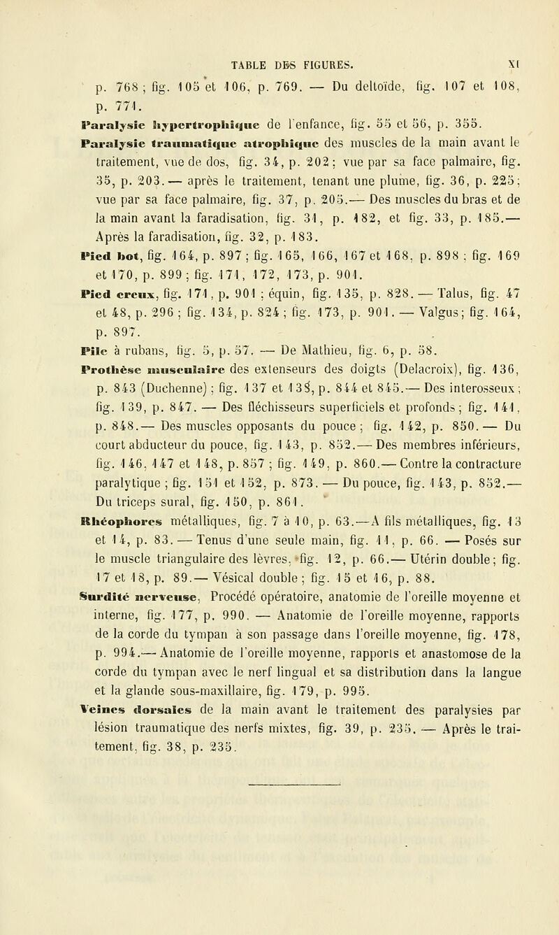 ~ p. 768; fig. 105 et 106, p. 769. ~ Du deltoïde, fig. 107 et 108, p. 771. Paralysie hypcrtrophique de l'enfance, fig. 55 et 56, p. 355. Paralysie trauiuatif|ue atropliîquc des miiscles de la main avant le traitement, vue de dos, fig. 34, p. 202; vue par sa face palmaire, fig. 35, p. 203.— après le traitement, tenant une plume, fig. 36, p. 225; vue par sa face palmaire, fig. 37, p. 205.— Des muscles du bras et de la main avant la faradisation, fig. 3-1, p. 4 82, et fig. 33, p. 185.— Après la faradisation, fig. 32, p. 183. Pied bot, fig. 164, p. 897; fig. 165, 166, 167 et 168, p. 898 ; fig. 169 et 170, p. 899; fig. 171, 172, 173, p. 901. Pied creux, fig. 171, p. 901 ; équin, fig, 135, p. 828. — Talus, fig. 47 et 48, p. 296; fig. 134, p. 824; fig. 173, p. 901. —Valgus; fig. 164, p. 897. Pile à rubans, fig. 5, p. 57. — De Mathieu, fig. 6, p. 58. Prothèse muscnlaîre des extenseurs des doigts (Delacroix), fig. 136, p. 843 (Duchenne) ; fig. 1 37 et 1 3^, p. 844 et 845.— Des interosseux ; fig. 139, p. 847. — Des fléchisseurs superficiels et profonds; fig. 141, p. 848.— Des muscles opposants du pouce; fig. 142, p. 850.— Du court abducteur du pouce, fig. 143, p. 852.— Des membres inférieurs, fig. 1 46. 147 et 1 48, p. 857 ; fig. 1 49, p. 860.— Contre la contracture paralytique ; fig. 151 et 152, p. 873. — Du pouce, fig. 143, p. 852.— Du triceps sural, fig. 1 50, p. 861. Rhéophores métalliques, fig. 7 à 10, p. 63.—A fils métalliques, fig. 18 et 14, p. 83. — Tenus d'une seule main, fig. 11, p. 66. —Posés sur le muscle triangulaire des lèvres.'fig. 12, p. 66.— Utérin double; fig. 17 et 18, p. 89.—Vésical double; fig. 15 et 16, p. 88. Surdité nerveuse, Procédé opératoire, anatomie de l'oreille moyenne et interne, fig. 177, p. 990. — Anatomie de l'oreille moyenne, rapports de la corde du tympan à son passage dans l'oreille moyenne, fig. 178, p. 994.— Anatomie de l'oreille moyenne, rapports et anastomose de la corde du tympan avec le nerf lingual et sa distribution dans la langue et la glande sous-maxillaire, fig. 179, p. 995. Veines dorsales de la main avant le traitement des paralysies par lésion traumatique des nerfs mixtes, fig. 39, p. 235. — Après le trai- tement, fig. 38, p. 235.