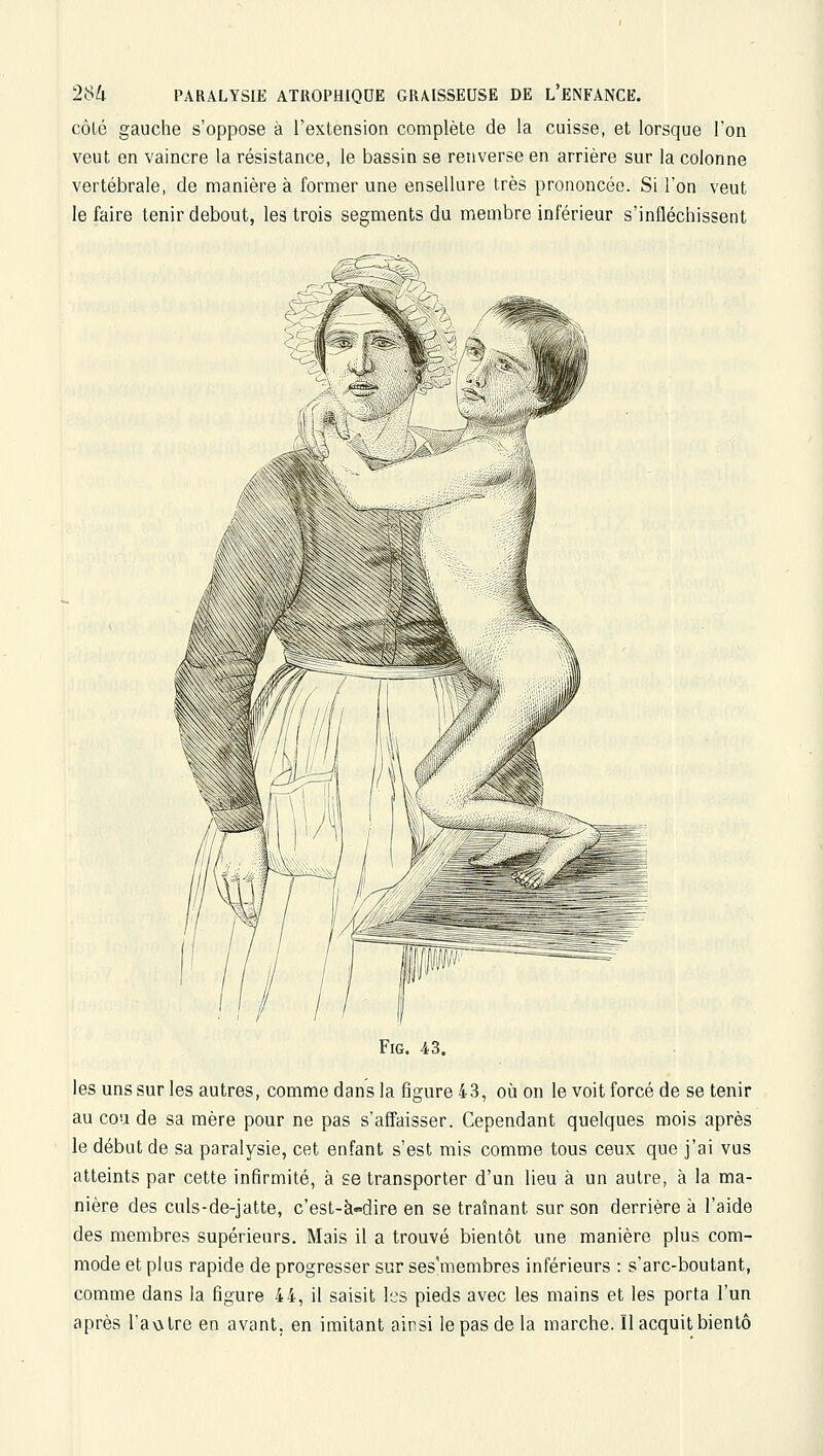 côté gauche s'oppose à l'extension complète de la cuisse, et lorsque l'on veut en vaincre la résistance, le bassin se renverse en arrière sur la colonne vertébrale, de manière à former une ensellure très prononcée. Si l'on veut le faire tenir debout, les trois segments du membre inférieur s'infléchissent FiG. 43. les uns sur les autres, comme dans la figure 43, où on le voit forcé de se tenir au cou de sa mère pour ne pas s'affaisser. Cependant quelques mois après le début de sa paralysie, cet enfant s'est mis comme tous ceux que j'ai vus atteints par cette infirmité, à se transporter d'un lieu à un autre, à la ma- nière des culs-de-jatte, c'est-à«dire en se traînant sur son derrière à l'aide des membres supérieurs. Mais il a trouvé bientôt une manière plus com- mode et plus rapide de progresser sur ses'membres inférieurs : s'arc-boutant, comme dans la figure 44, il saisit les pieds avec les mains et les porta l'un après l'avNtre en avant, en imitant ainsi le pas de la marche. Il acquit bientô
