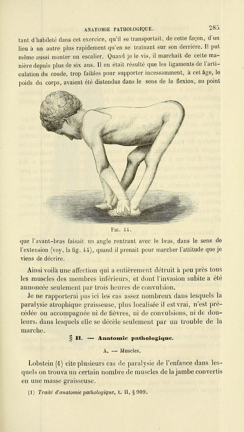 tant d'habileté dans cet exercice, qu'il se transportait, de cette façon, d'un lieu à un autre plus rapidement qu'en se traînant sur son derrière. Il put même aussi monter un escalier. Quand je le vis, il marchait de celte ma- nière depuis plus de six ans. Il en était résulté que les ligaments de l'arti- culation du coude, trop faibles pour supporter incessamment, à cet âge, le poids du corps, avaient été distendus dans le sens de la flexion, au point FiG. 44. que l'avant-bras faisait un angle rentrant avec le bras, dans le sens de l'extension (voy. la fig. 44), quand il prenait pour marcher l'attitude que je viens de décrire. Ainsi voilà une affection qui a entièrement détruit à peu près tous les muscles des membres inférieurs, et dont l'invasion subite a été annoncée seulement par trois heures de convulsion. Je ne rapporterai pas ici les cas assez nombreux dans lesquels la paralysie atrophique graisseuse, plus localisée il est vrai, n'est pré- cédée ou accompagnée ni de fièvres, ni de convulsions, ni de dou- leurs, dans lesquels elle se décèle seulement par un trouble de la marche. § II. '— Anatomie pathologique. A. — Muscles. Lobstein (4) cite plusieurs cas de paralysie de l'enPance dans les- quels on trouva un certain nombre de muscles de la jambe convertis en une masse graisseuse. (1) Traité d'anatomie pathologique, t. II, §909.