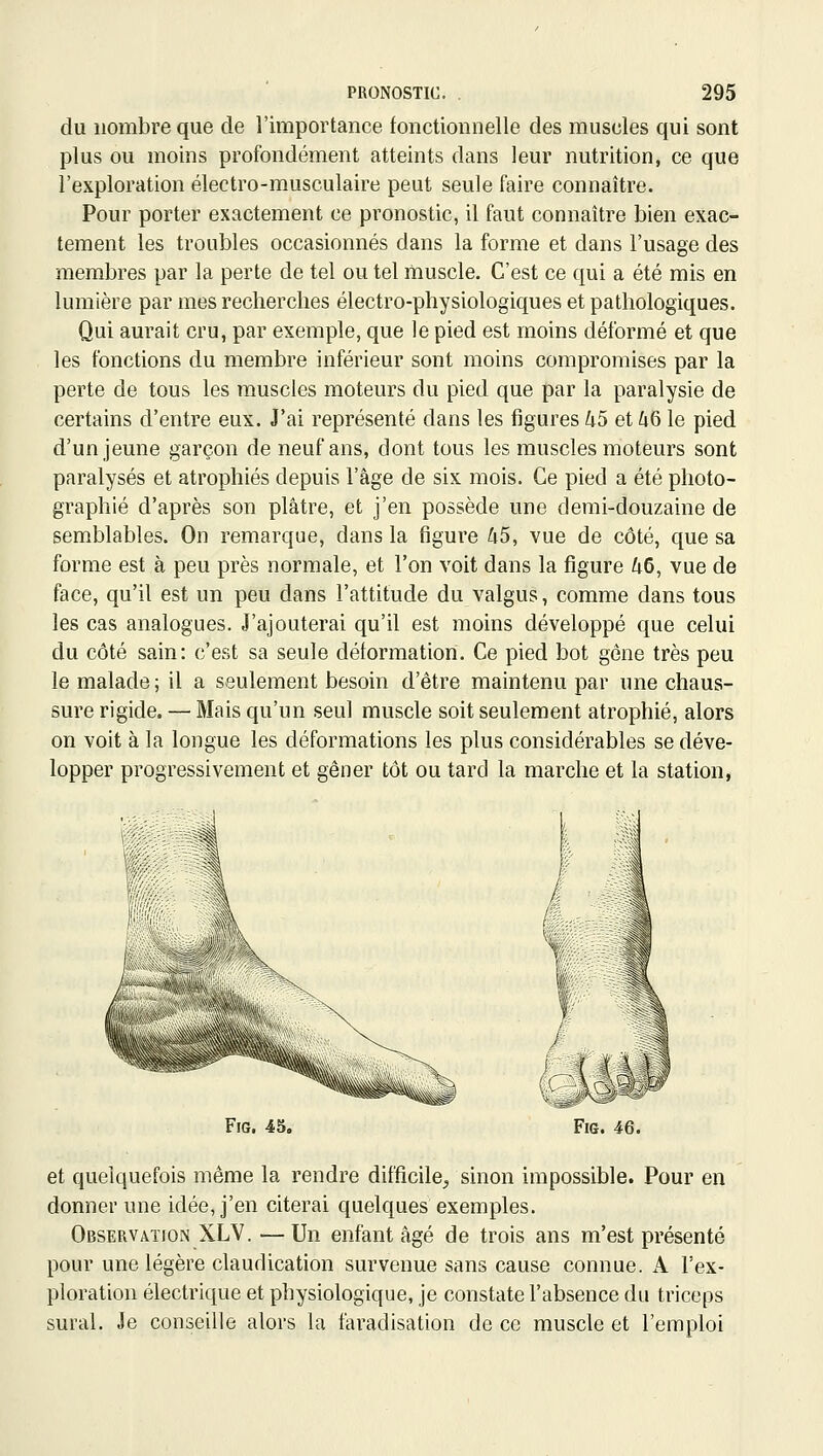 du nombre que de l'importance fonctionnelle des muscles qui sont plus ou moins profondément atteints dans leur nutrition, ce que l'exploration électro-musculaire peut seule faire connaître. Pour porter exactement ce pronostic, il faut connaître bien exac- tement les troubles occasionnés dans la forme et dans l'usage des membres par la perte de tel ou tel muscle. C'est ce qui a été mis en lumière par mes recherches électro-physiologiques et pathologiques. Qui aurait cru, par exemple, que le pied est moins déformé et que les fonctions du membre inférieur sont moins compromises par la perte de tous les muscles moteurs du pied que par la paralysie de certains d'entre eux. J'ai représenté dans les figures 45 et 46 le pied d'un jeune garçon de neuf ans, dont tous les muscles moteurs sont paralysés et atrophiés depuis l'âge de six mois. Ce pied a été photo- graphié d'après son plâtre, et j'en possède une demi-douzaine de semblables. On remarque, dans la figure 45, vue de côté, que sa forme est à peu près normale, et l'on voit dans la figure 46, vue de face, qu'il est un peu dans l'attitude du valgus, comme dans tous les cas analogues. J'ajouterai qu'il est moins développé que celui du côté sain: c'est sa seule déformation. Ce pied bot gène très peu le malade; il a seulement besoin d'être maintenu par une chaus- sure rigide. — Mais qu'un seul muscle soit seulement atrophié, alors on voit à la longue les déformations les plus considérables se déve- lopper progressivement et gêner tôt ou tard la marche et la station, FiG. 45. et quelquefois même la rendre difficile^ sinon impossible. Pour en donner une idée, j'en citerai quelques exemples. Observation XLV. —Un enfant âgé de trois ans m'est présenté pour une légère claudication survenue sans cause connue. A l'ex- ploration électrique et physiologique, je constate l'absence du triceps sural. Je conseille alors la faradisation de ce muscle et l'emploi