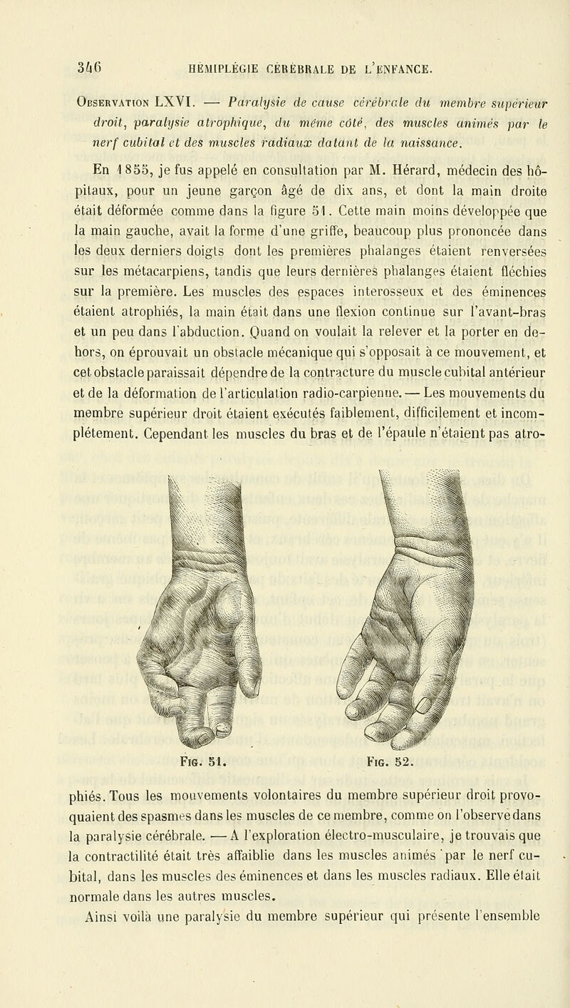 Observation LXVI. — Paralysie de cause cérébrale du membre supérieur droit, paralysie atrophique, du même côté, des muscles animés par le nerf cubital et des m,uscles radiaux datant de la naissance. En 1 853, je fus appelé en consultation par M. Hérard, médecin des hô- pitaux, pour un jeune garçon âgé de dix ans, et dont la main droite était déformée comme dans la figure 51. Cette main moins développée que la main gauche, avait la forme d'une griffé, beaucoup plus prononcée dans les deux derniers doigts dont les premières phalanges étaient renversées sur les métacarpiens, tandis que leurs dernières phalanges étaient fléchies sur la première. Les muscles des espaces interosseux et des éminences étaient atrophiés, la main était dans une flexion continue sur l'avant-bras et un peu dans l'abduction. Quand on voulait la relever et la porter en de- hors, on éprouvait un obstacle mécanique qui s'opposait à ce mouvement, et cet obstacle paraissait dépendre de la contracture du muscle cubital antérieur et de la déformation de l'articulation radio-carpienne. — Les mouvements du membre supérieur droit étaient exécutés faiblement, difficilement et incom- plètement. Cependant les muscles du bras et de l'épaule n'étaient pas atro- FiG. 52. phiés.Tous les mouvements volontaires du membre supérieur droit provo- quaient des spasmes dans les muscles de ce membre, comme on l'observe dans la paralysie cérébrale. ■—A l'exploration électro-musculaire, je trouvais que la contractilité était très affaiblie dans les muscles animés par le nerf cu- bital, dans les muscles des éminences et dans les muscles radiaux. Elle était normale dans les autres muscles. Ainsi voilà une paralysie du membre supérieur qui présente l'ensemble