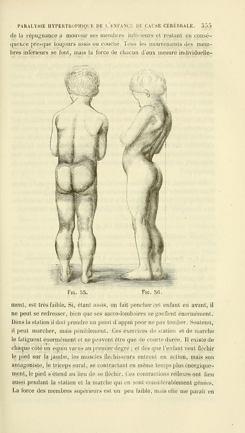 de la répugnance à mouvoir ses membres infùi'ieurs et restant en consé- quefvce presque toujours assis ou couclié. Tous les mouvements des mem- bres inférieurs se font, mais la force de chacun d'eux mesuré individuelle- FiG. 35. FiG. 56. ment, est très faible. Si, étant assis, on fait pencher cet enfant en avant, il ne peut se redresser, bien que ses sacro-lombaires se gonflent énormément. Dans la station il doit prendre un point d'appui pour ne pas tomber. Soutenu, il peut marcher, mais péniblement. Ces exercices de station et de marche le fatiguent énormément et ne peuvent être que de courte durée. 11 existe de chaque côté un equin varus au premier degré ; et dès que l'enfant veut fléchir le pied sur la jambe, les muscles fléchisseurs entrent en action, mais son antagoniste, le triceps sura!, se contractant en même temps plus énergique- ment, le pied s'étend au lieu de se fléchir. Ces contractions réflexes ont lieu aussi pendant la station et la marche qui en sont considérablement gênées. La force des membres supérieurs est un peu faible, mais elle me paraît en