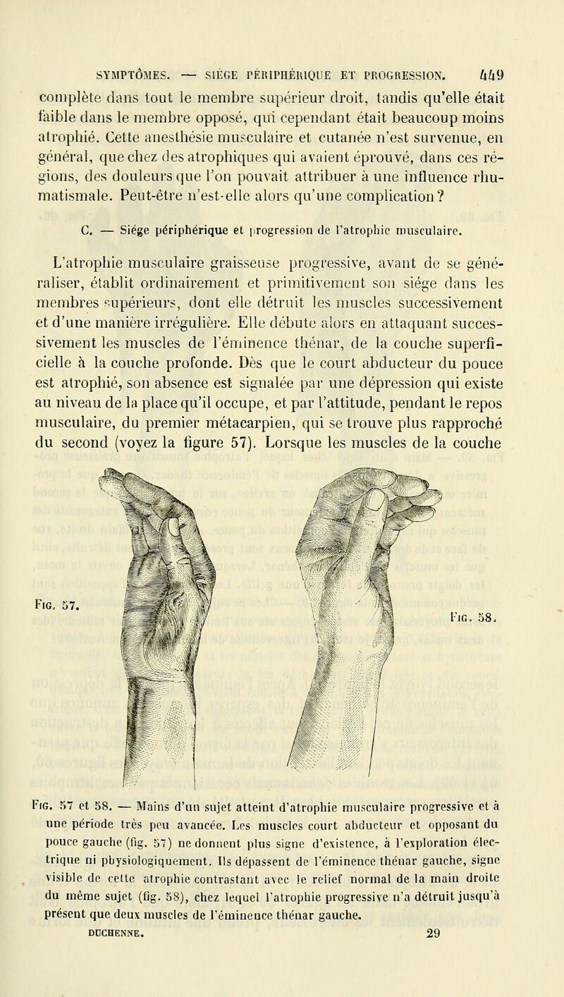 complète dans tout le membre supérieur droit, tandis qu'elle était faible dans le membre opposé, qui cependant était beaucoup moins atrophié. Cette aneslhésie musculaire et cutanée n'est survenue, en général, que chez desatrophiques qui avaient éprouvé, dans ces ré- gions, des douleurs que l'on pouvait attribuer à une influence rhu- matismale. Peut-être n'est-elle alors qu'une complication? C. — Siège périphérique et progression de l'atrophie musculaire. L'atrophie musculaire graisseuse progressive, avant de se géné- raliser, établit ordinairement et primitivement son siège dans les membres 'supérieurs, dont elle détruit les muscles successivement et d'une manière irrégulière. Elle débute alors en attaquant succes- sivement les muscles de l'éminence thénar, de la couche superfi- cielle à la couche profonde. Dès que le court abducteur du pouce est atrophié, son absence est signalée par une dépression qui existe au niveau de la place qu'il occupe, et par l'attitude, pendant le repos musculaire, du premier métacarpien, qui se trouve plus rapproché du second (voyez la figure 57). Lorsque les muscles de la couche F[G. o7. I-iG. 58. F(G. 57 et 58. — Mains d'un sujet atteint d'atrophie musculaire progressive et à une période très peu avancée. Les muscles court abducteur et opposant du pouce gauche (fig. 57) ne donnent plus signe d'existence, à l'exploration élec- trique ni pbysiologiquement. Ils dépassent de l'éminence thénar gauche, signe visible de celte atrophie contrastant avec le relief normal de la main droite du même sujet (fig. 58), chez lequel l'atrophie progressive n'a détruit jusqu'à présent que deux muscles de l'éminence thénar gauche. DDCHENNE. 29