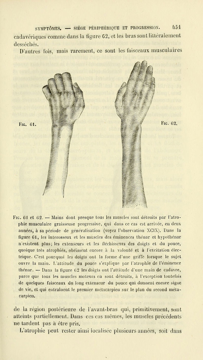 cadavériques comme dans la figure 62, et les bras sont littéralement desséchés. D'autres fois, mais rarement, ce sont les faisceaux musculaires FiG. 61. FiG. 62. FiG. 61 et 62, — Mains dont presque tous les muscles sont détruits par l'atro- phie musculaire graisseuse progressive, qui dans ce cas est arrivée, eu deux années, à sa période de généralisation (voyez l'observation XGIX). Dans la figure 61, les interosseux et les muscles des éminences thénar et hypothénar n'existent plus; les extenseurs et les fléchisseurs des doigts et du pouce, quoique très atrophiés, obéissent encore à la volonté et à l'excitation élec- trique. C'est pourquoi les doigts ont la forme d'une griffe lorsque le sujet ouvre la main. L'attitude du pouce s'explique par l'atrophie de l'éminence thénar. — Dans la figure 62 les doigts ont l'attitude d'une main de cadavre, parce que tous les muscles moteurs en sont détruits, à l'exception toutefois de quelques faisceaux du long extenseur du pouce qui donnent encore signe de vie, et qui entraînent le premier métacarpien sur le plan du second méta- carpien. de la région postérieure de l'avant-bras qui, primitivement, sont atteints partiellement. Dans ces cas mêmes, les muscles précédents ne tardent pas à être pris. L'atrophie peut rester ainsi localisée plusieurs années, soit dans