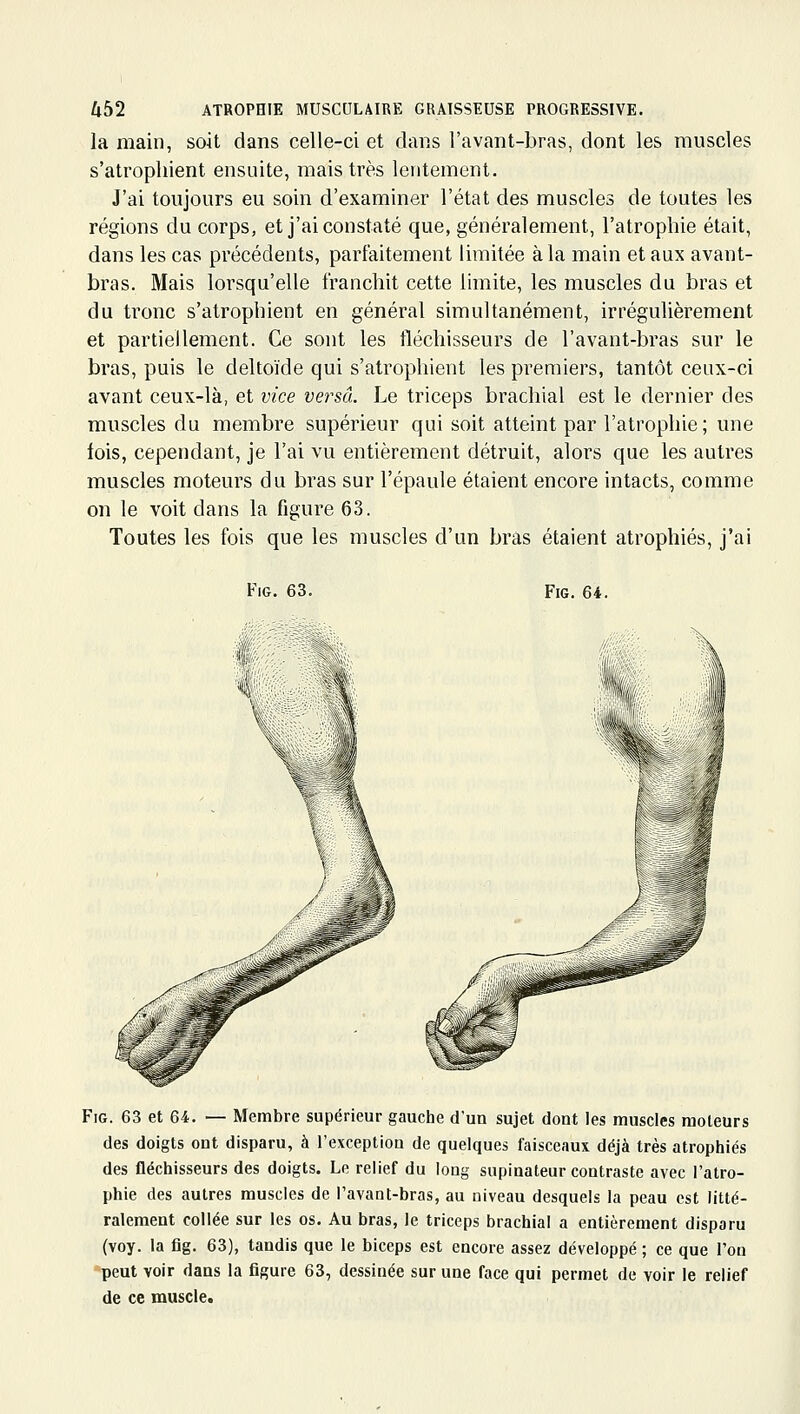 la main, soit dans celle-ci et dar.s l'avant-bras, dont les muscles s'atrophient ensuite, mais très lentement. J'ai toujours eu soin d'examiner l'état des muscles de toutes les régions du corps, et j'ai constaté que, généralement, l'atrophie était, dans les cas précédents, parfaitement limitée à la main et aux avant- bras. Mais lorsqu'elle franchit cette limite, les muscles du bras et du tronc s'atrophient en général simultanément, irrégulièrement et partiellement. Ce sont les fléchisseurs de l'avant-bras sur le bras, puis le deltoïde qui s'atrophient les premiers, tantôt ceux-ci avant ceux-là, et vice versa. Le triceps brachial est le dernier des muscles du membre supérieur qui soit atteint par l'atrophie; une fois, cependant, je l'ai vu entièrement détruit, alors que les autres muscles moteurs du bras sur l'épaule étaient encore intacts, comme on le voit dans la figure 63. Toutes les fois que les muscles d'un bras étaient atrophiés, j'ai FiG. 63. FiG. 64. FiG. 63 et 64. — Membre supérieur gauche d'un sujet dont les muscles moteurs des doigts ont disparu, à l'exception de quelques faisceaux déjà très atrophiés des fléchisseurs des doigts. Le relief du long supinateur contraste avec l'atro- phie des autres muscles de l'avant-bras, au niveau desquels la peau est litté- ralement collée sur les os. Au bras, le triceps brachial a entièrement disparu (voy. la fig. 63), tandis que le biceps est encore assez développé ; ce que l'on peut voir dans la figure 63, dessinée sur une face qui permet de voir le relief de ce muscle.