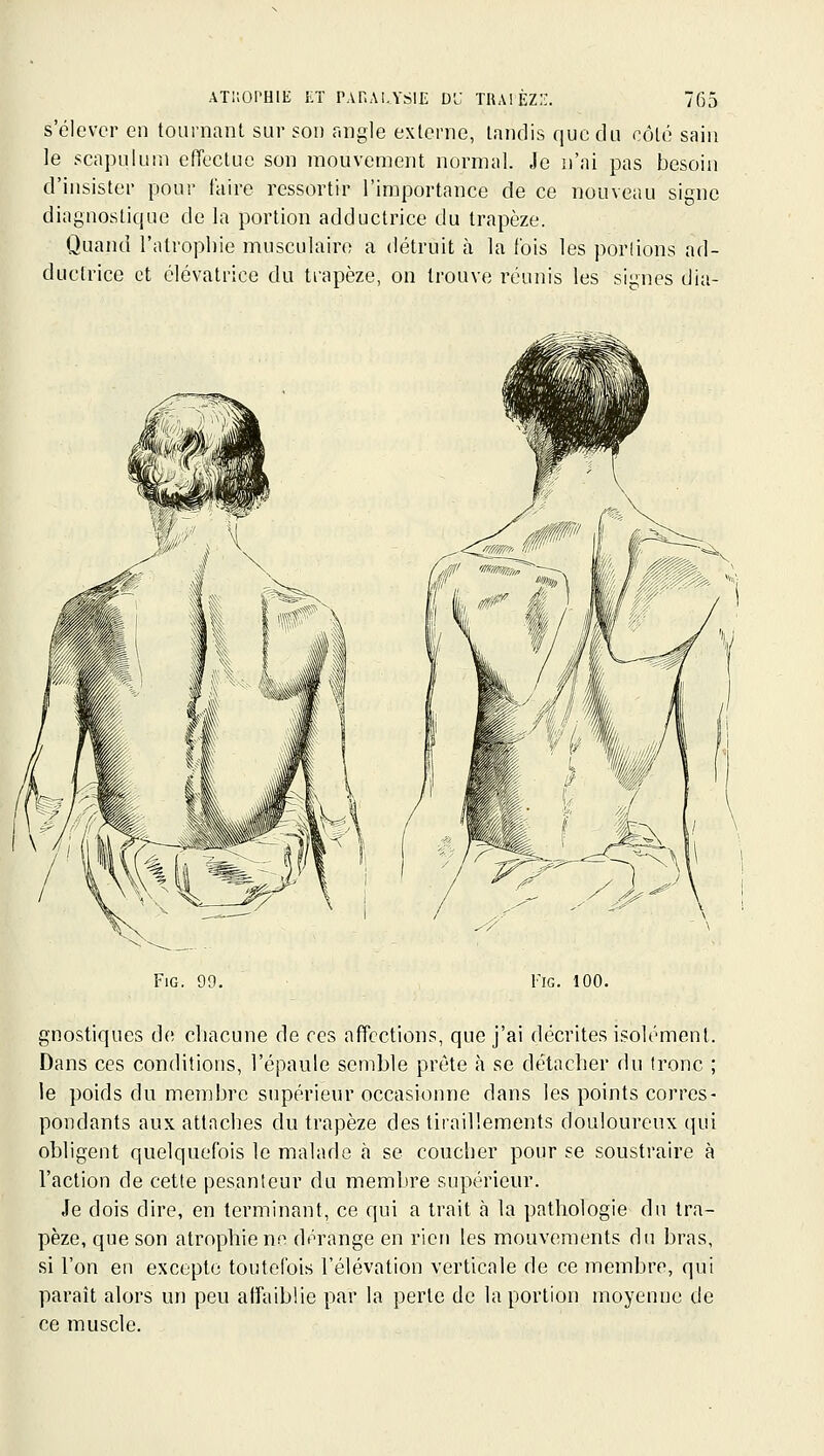 s'élever en tournant sur son r.ngle externe, tandis que du coté sain le scapuluiu effectue son mouvement normal. Je n'ai pas besoin d'insister pour faire ressortir l'importance de ce nouveau signe diagnostique de la portion adductrice du trapèze. Quand l'atrophie musculaire a détruit à la fois les portions ad- ductrice et élévatrlce du trapèze, on trouve réunis les signes dia- FiG. 99. 1IG. 100. gnostiques de chacune de ces affections, que j'ai décrites isolément. Dans ces conditions, l'épaule semble prête à se détacher du tronc ; le poids du membre supérieur occasionne dans les points corres- pondants aux attaches du trapèze des tiraillements douloureux qui obligent quelquefois le malade à se coucher pour se soustraire à l'action de cette pesanteur du membre supérieur. Je dois dire, en terminant, ce qui a trait à la pathologie du tra- pèze, que son atrophie no dérange en rien les mouvements du bras, si l'on en excepte toutefois l'élévation verticale de ce membre, qui parait alors un peu affaiblie par la perte de la portion moyenne de ce muscle.