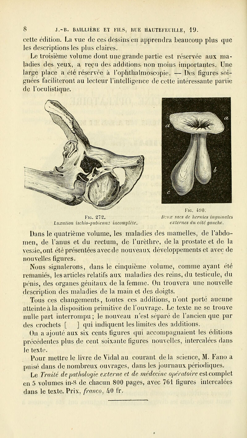 cette édition. La vue de ces dessins en apprendra beaucoup plus que les descriptions les plus claires. Le troisième volume dont une grande partie est réservée aux ma- ladies des yeux, a reçu des additions non moins importantes. Une large place a été réservée à l'ophtlialmoscopie. — Des figures soi- gnées faciliteront au lecteur l'intelligence de cette intéressante partie de l'oculistique. FiG. 272. Liuxaiion ischio-pubienns incomplète. FiG. 490. D:ux sacs de hernies inguinales externes du coté gauche. Dans le quatrième volume, les maladies des mamelles, de l'abdo- men, de l'anus et du rectum, de l'urètbre, de la prostate et de la vessie, ont été présentées avec de nouveaux développements et avec de nouvelles figures. Nous signalerons, dans le cinquième volume, comme ayant été remaniés, les articles relatifs aux maladies des reins, du testicule, du pénis, des organes génitaux de la femme. On trouvera une nouvelle description des maladies de la main et des doigts. Tous ces changements, toutes ces additions, n'ont porté aucune atteinte à la disposition primitive de l'ouvrage. Le texte ne se trouve nulle part interrompu; le nouveau n'est séparé de l'ancien que par des crochets [ ] qui indiquent les limites des additions. On a ajouté aux six cents figures qui accompagnaient les éditions précédentes plus de cent soixante figures nouvelles, intercalées dans le texte. Pour mettre le livre de Vidal au courant delà science, M. Fano a puisé dans de nombreux ouvrages, dans les journaux périodiques. Le Irailé de pathologie externe et de médecine opératoire est complet en 5 volumes in-8 de chacun 800 pages, avec 761 figures intercalées dans le texte. Prix, franco, ^0 fr.